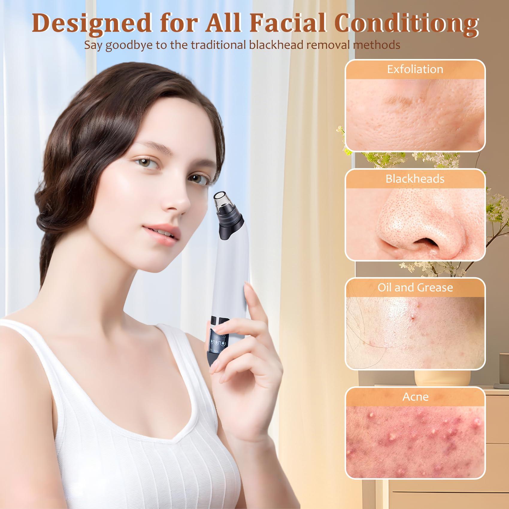 Blackhead Remover Vacuum - Powerful Pore Vacuum for Cleansing, Blackhead Extractor with 3 Adjustable Suction Levels, 4 Blackhead Removal Tools, USB Rechargeable，Suitable for Women and Men - Image 2