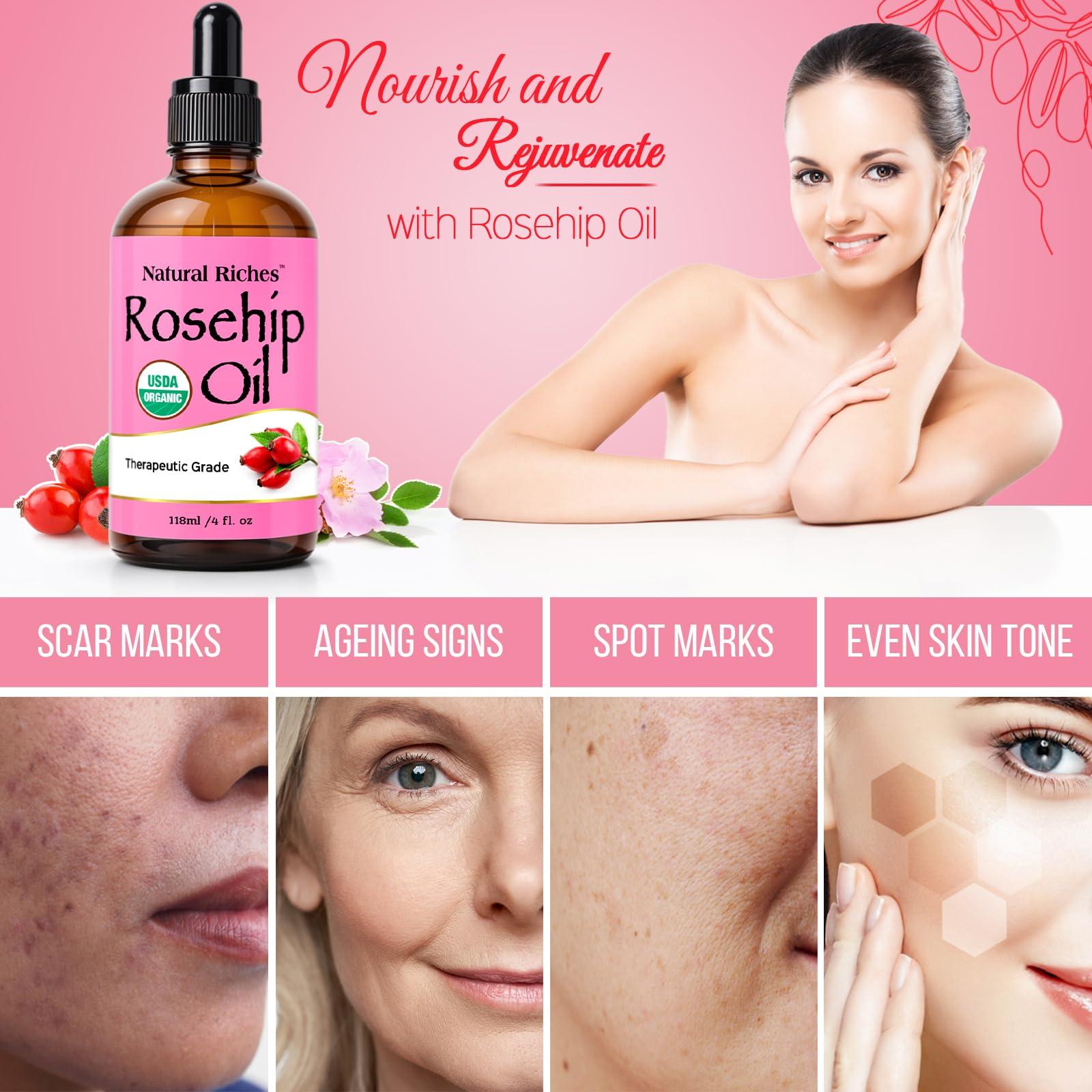 Natural Riches Organic Rosehip Seed Oil for Face 100% Pure Natural Cold Pressed Unrefined Non-GMO Carrier Oil for Skin Hair & Nails. 4 fl oz. - Image 5