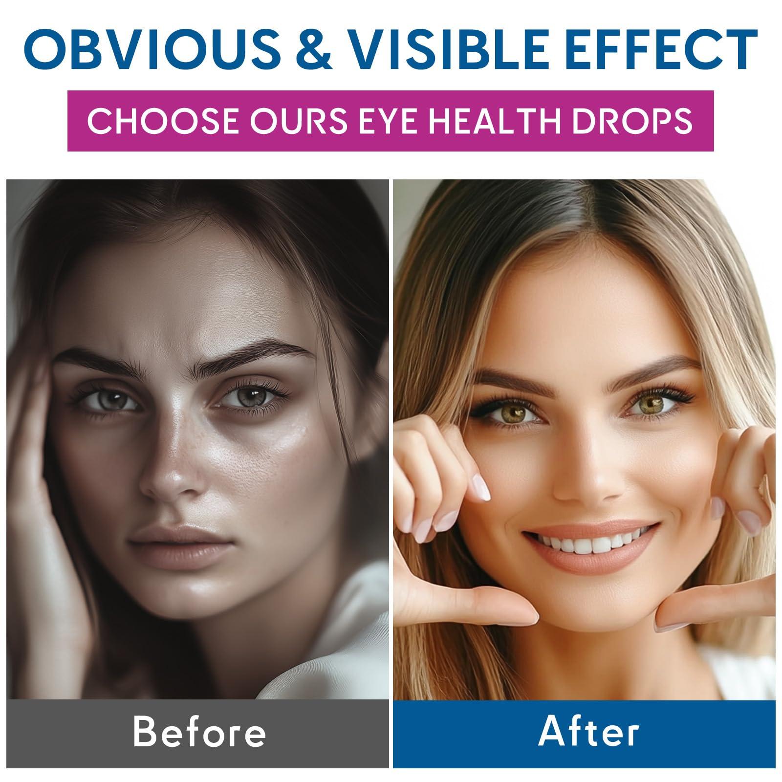 IHW 60ml Eyebright Herb Drops for Eye Health, Eye Fatigue & Dry Eye Support Herbal Supplements W/Euphrasia officinalis Bilberry Goji Leaves Blueberry Extract, Organic Eye Drops for Sight Care - Image 6