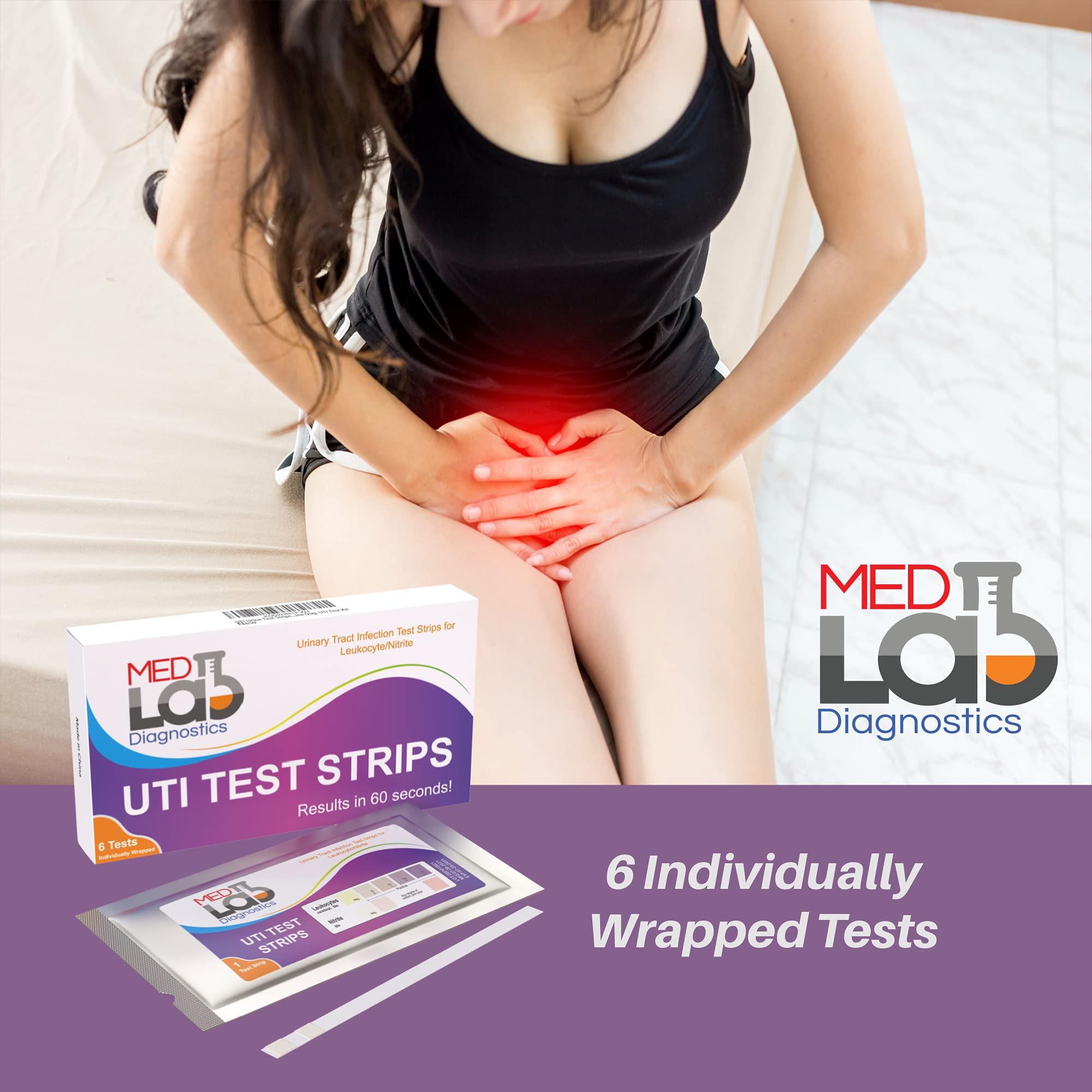 UTI Urine Test Strips(Pack of 6) Individually Wrapped Urinary Tract Infection UTI Test Kit for Women, Men, Kids Cats and Dogs - Image 6
