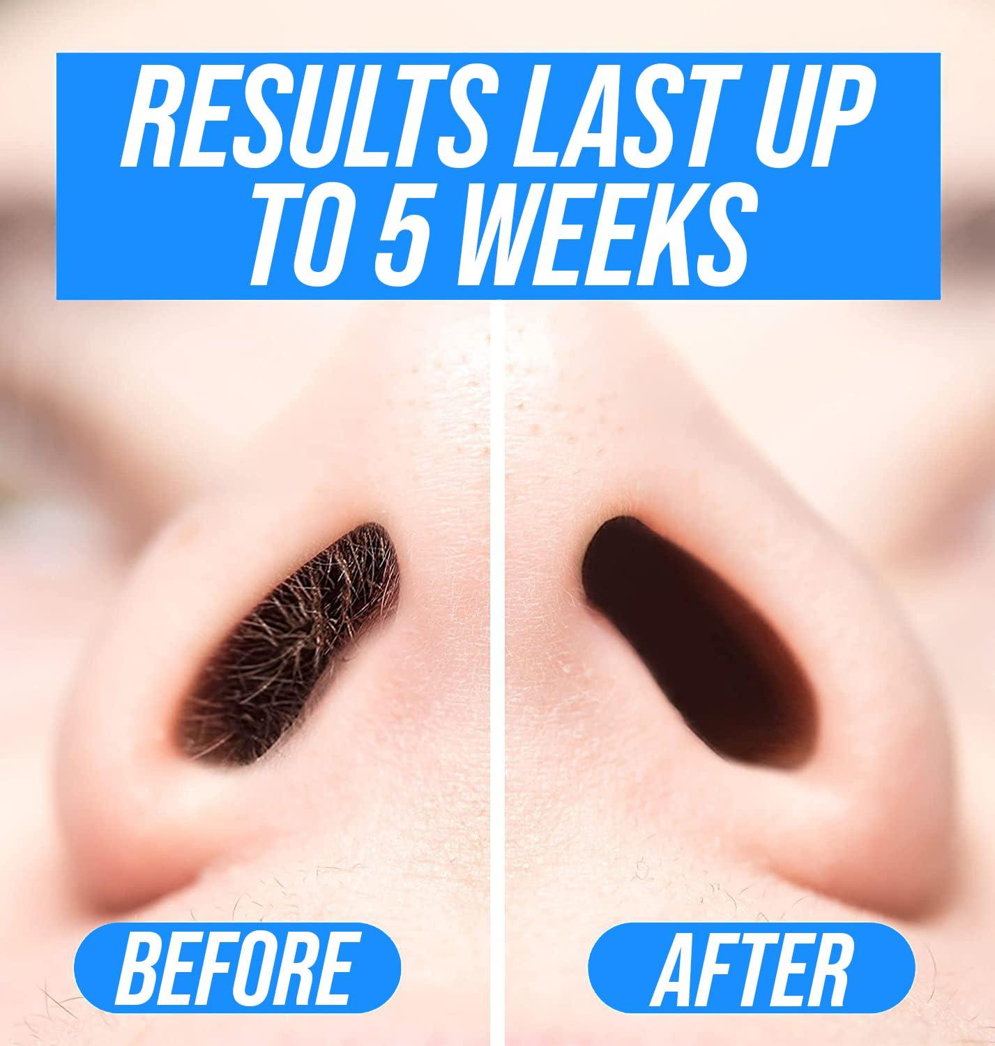KENASHII Nose Wax Kit | 100 g Wax, 24 Applicators | Hair Removal Kit for Men and Women | Includes Balm Wipes and Mustache Guards | Lasts up to 5 Weeks - Image 4