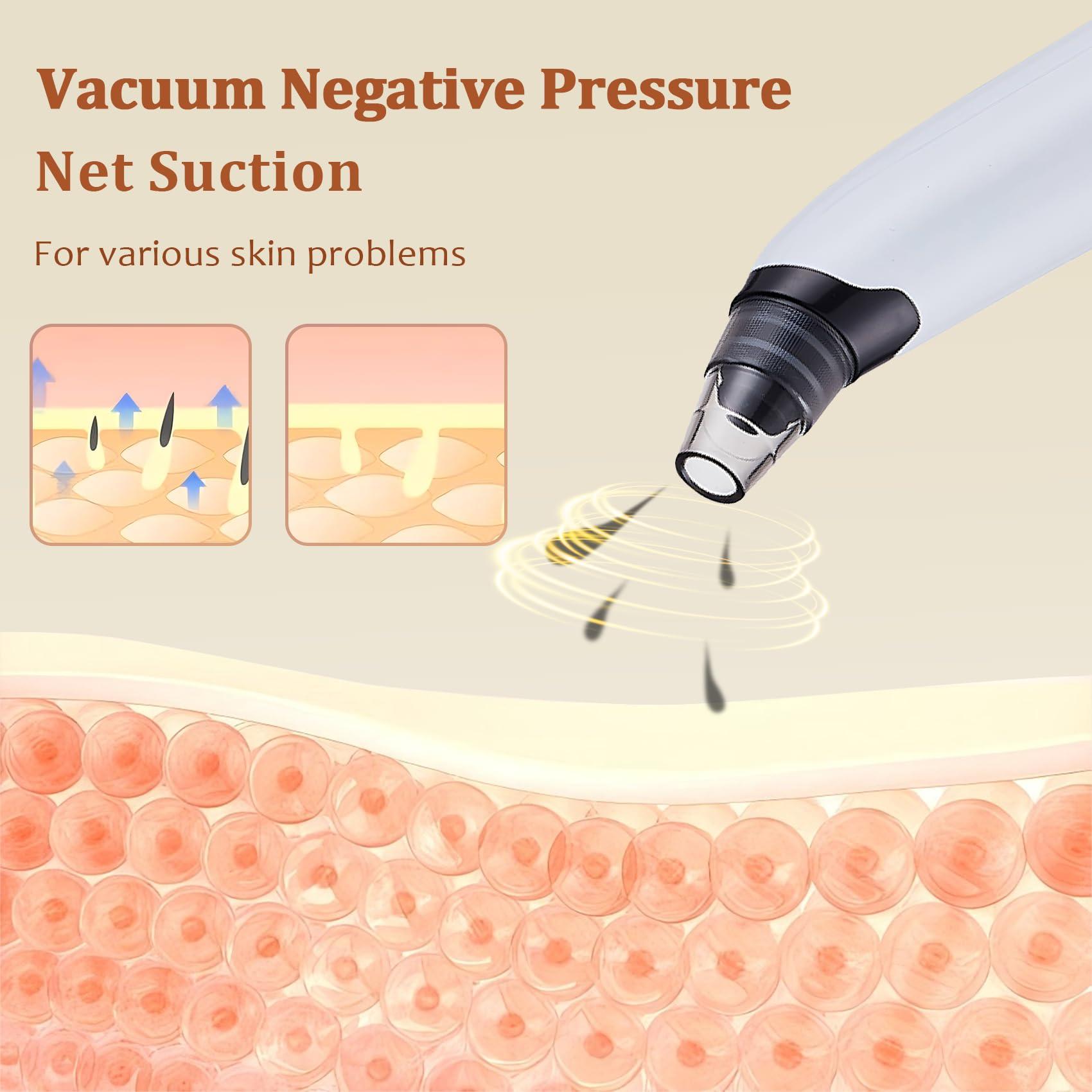 Blackhead Remover Vacuum - Powerful Pore Vacuum for Cleansing, Blackhead Extractor with 3 Adjustable Suction Levels, 4 Blackhead Removal Tools, USB Rechargeable，Suitable for Women and Men - Image 5