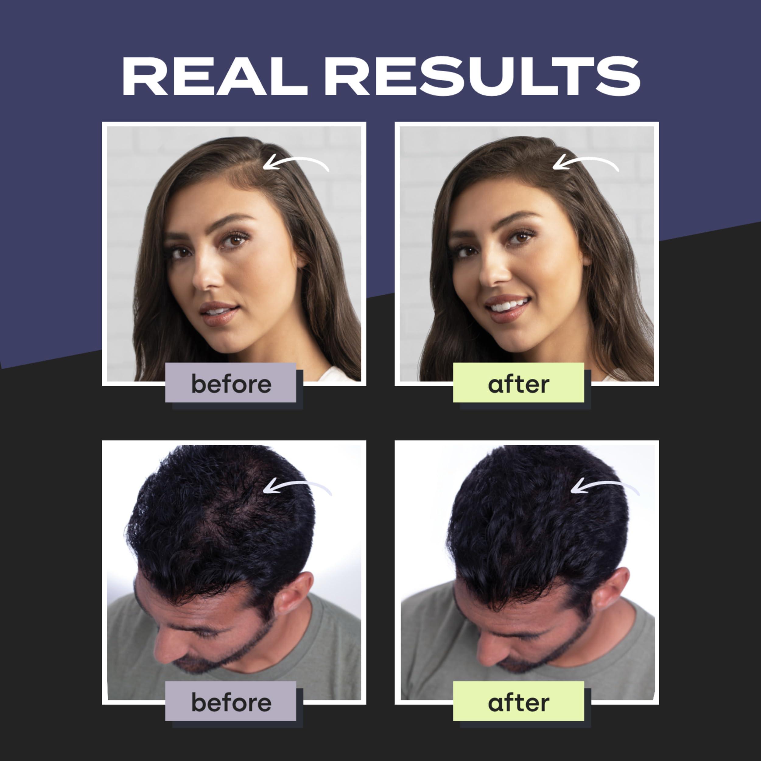 Toppik Hair Building Fibers, Fill In Fine or Thinning Hair Instantly Thicker, Fuller Looking Hair 9 Shades,4 size options - Image 3