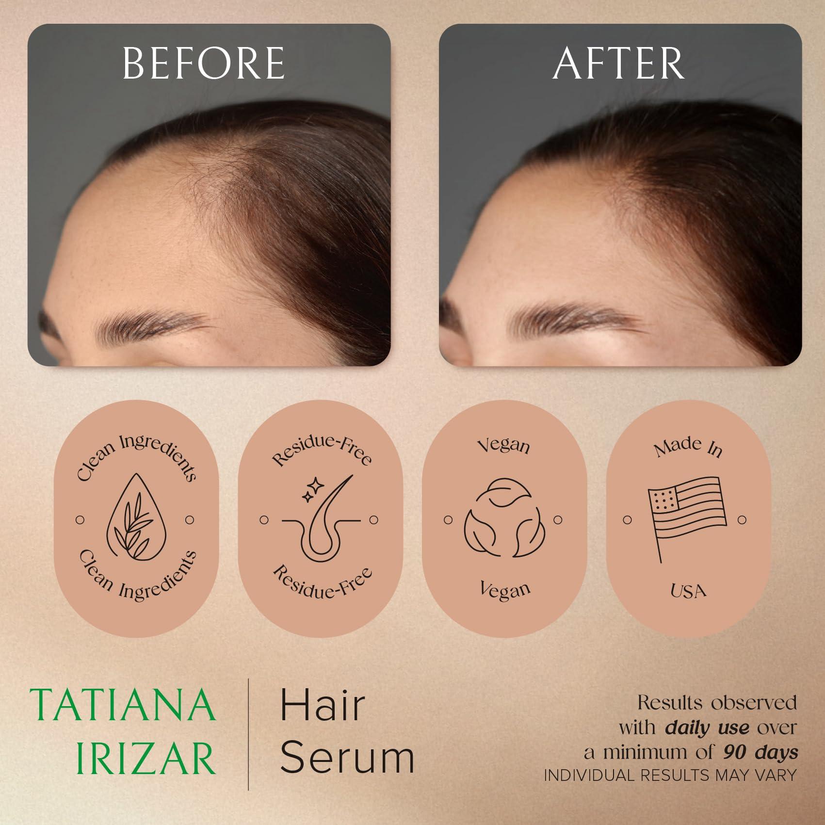 Hair Serum for Hair Growth Serum Women Made in USA - Scalp Serum for Hair Growth Non-Greasy Rosemary & Amla Hair Care - Natural 1 Fl.Oz Hair Loss Treatments for Women Regrowth Treatment - Image 3