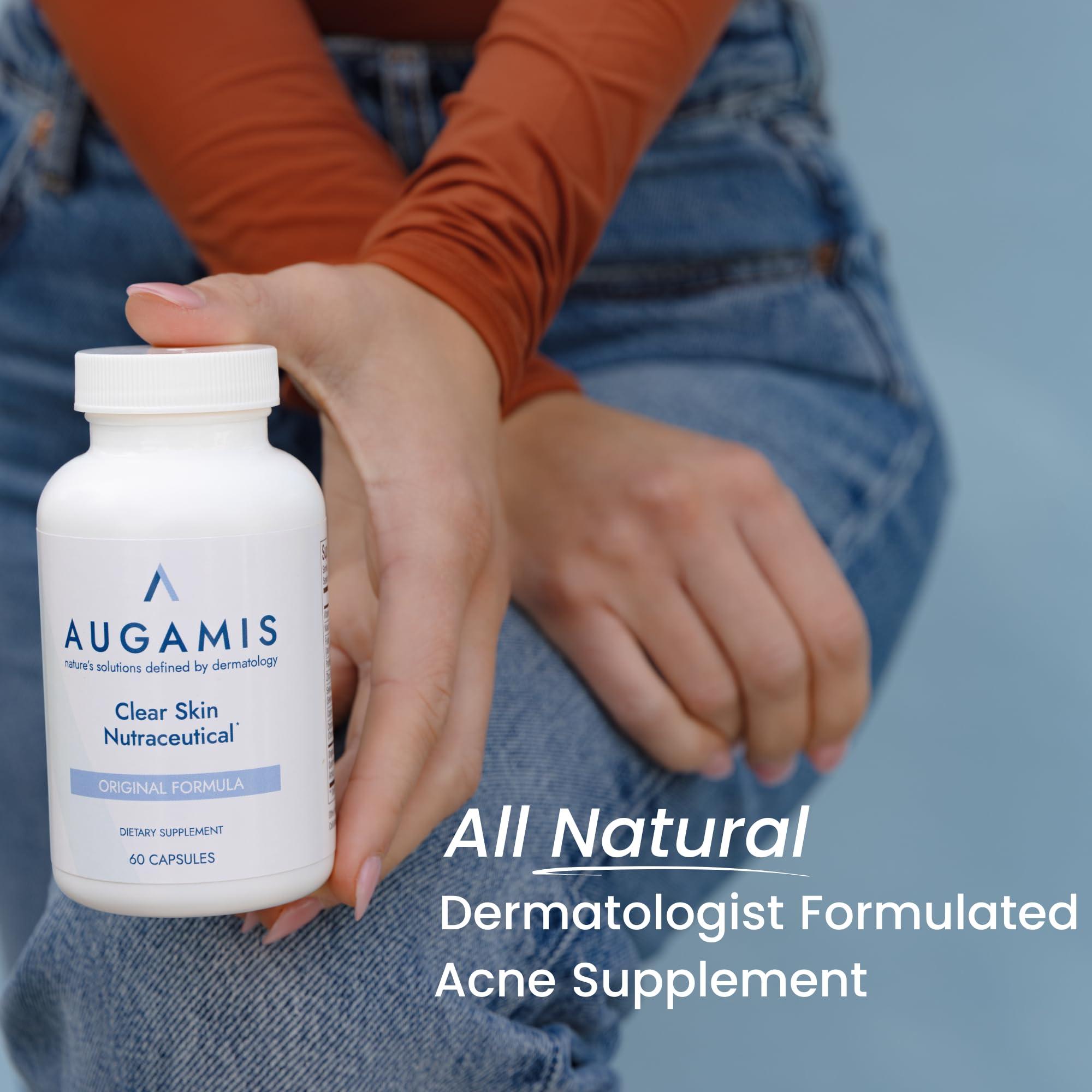 Hormonal Acne Treatment for Women - No DIM - (60 Capsules, 485 mg) – DIM-Free Acne Medication - Helps Nodular & Hormonal Acne - Best Acne Treatment for Teenagers & Adults - Image 2