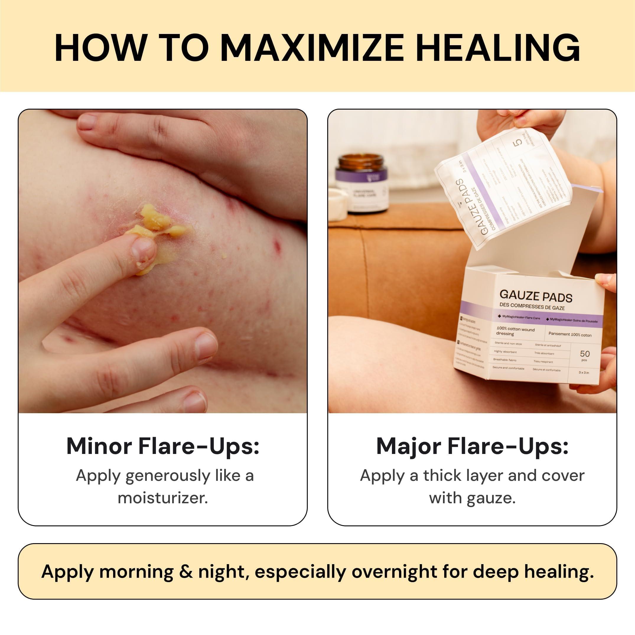 Universal Flare Care | Relief for 97% of Skin Issues | Cysts, Inflamed Skin, Hidradenitis Suppurativa, Abscesses, Impetigo | All Natural Flare Up Solution With Propolis & Egg Yolk Extract 1 oz - Image 7