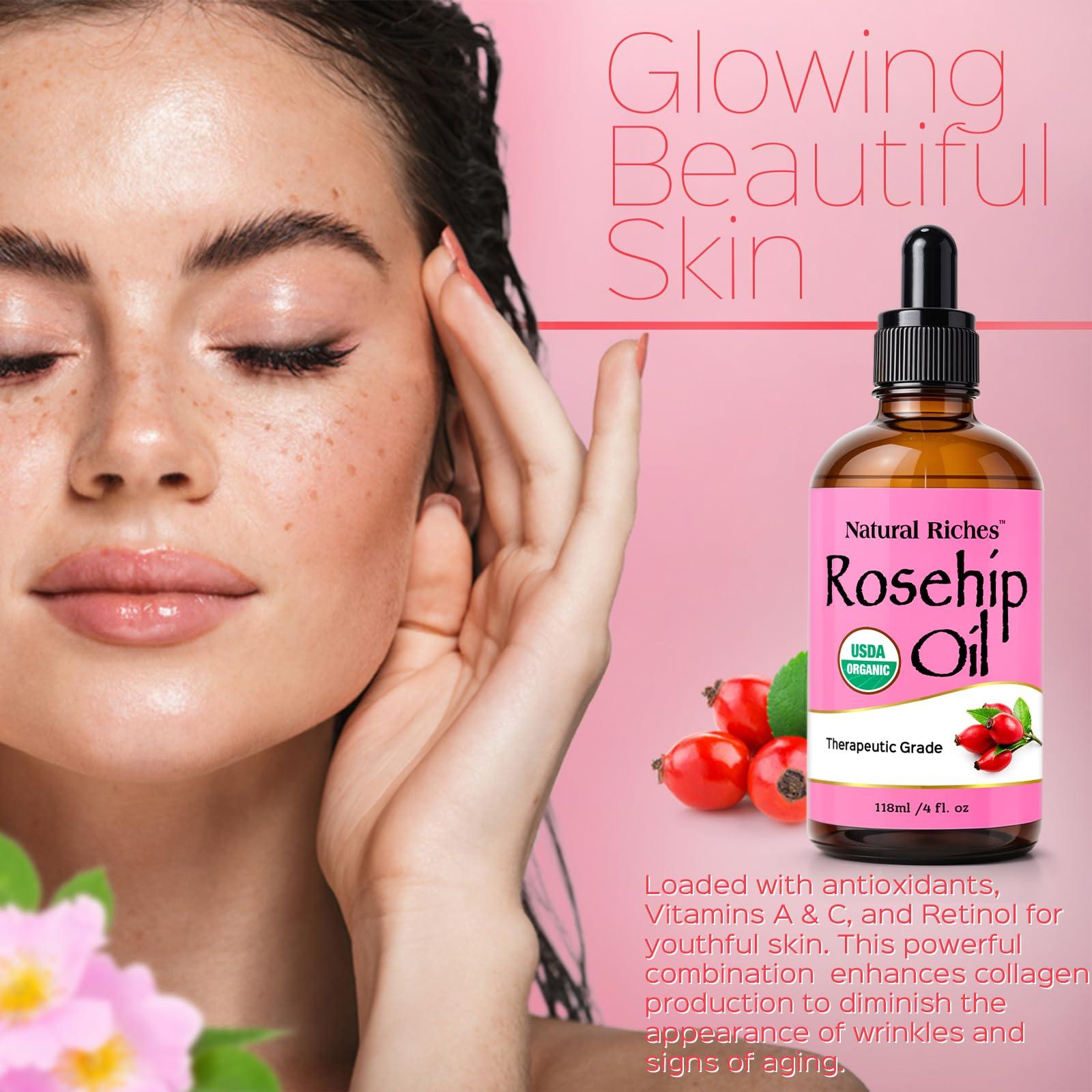 Natural Riches Organic Rosehip Seed Oil for Face 100% Pure Natural Cold Pressed Unrefined Non-GMO Carrier Oil for Skin Hair & Nails. 4 fl oz. - Image 4