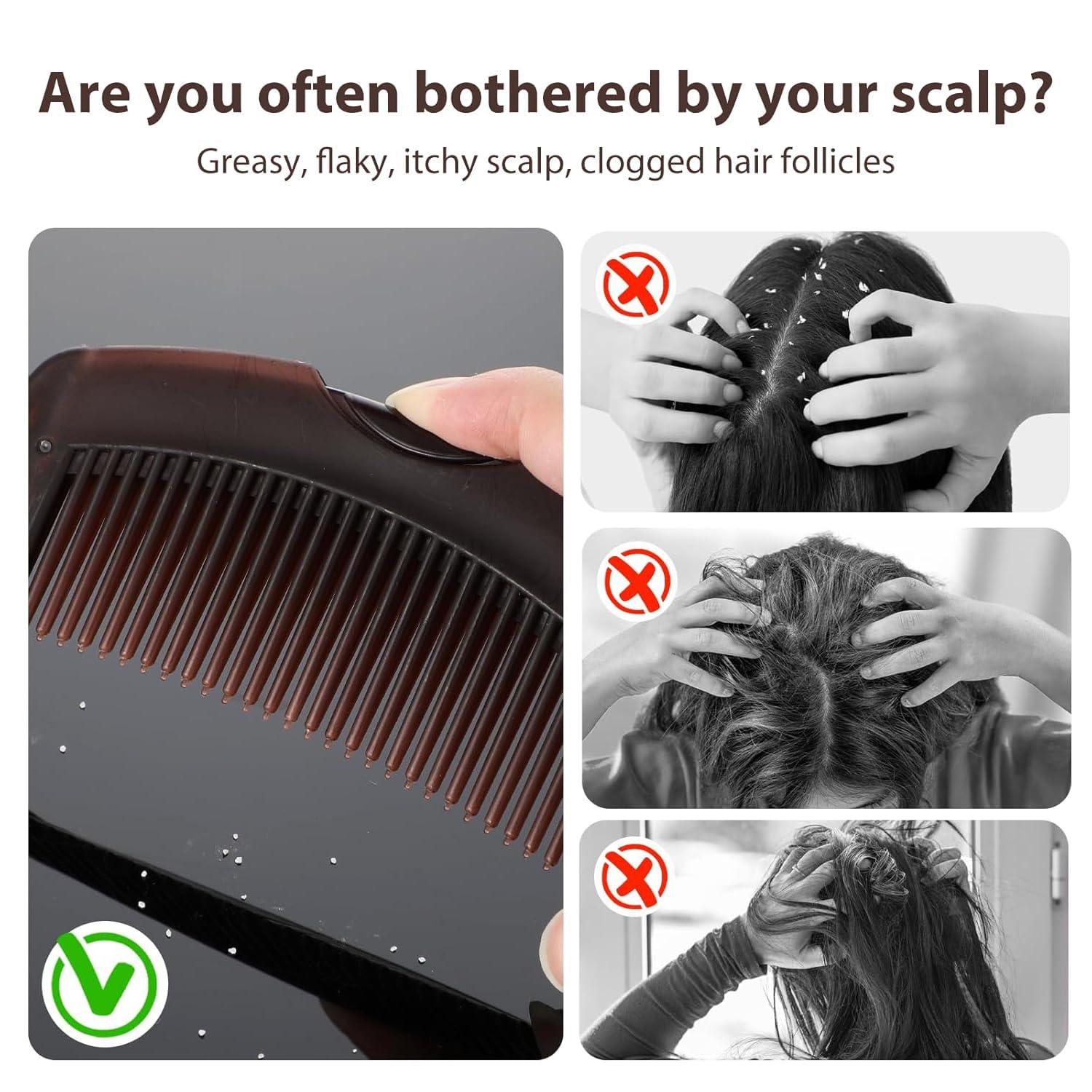 Dandruff Comb, Hollow Tooth Button Comb, Detoxing Comb Energy Massage Comb, Scalp Psoriasis Comb Dandruff Removal Comb, Lice Comb Multifunctional Hairbrush For Women Men Kids - Image 4
