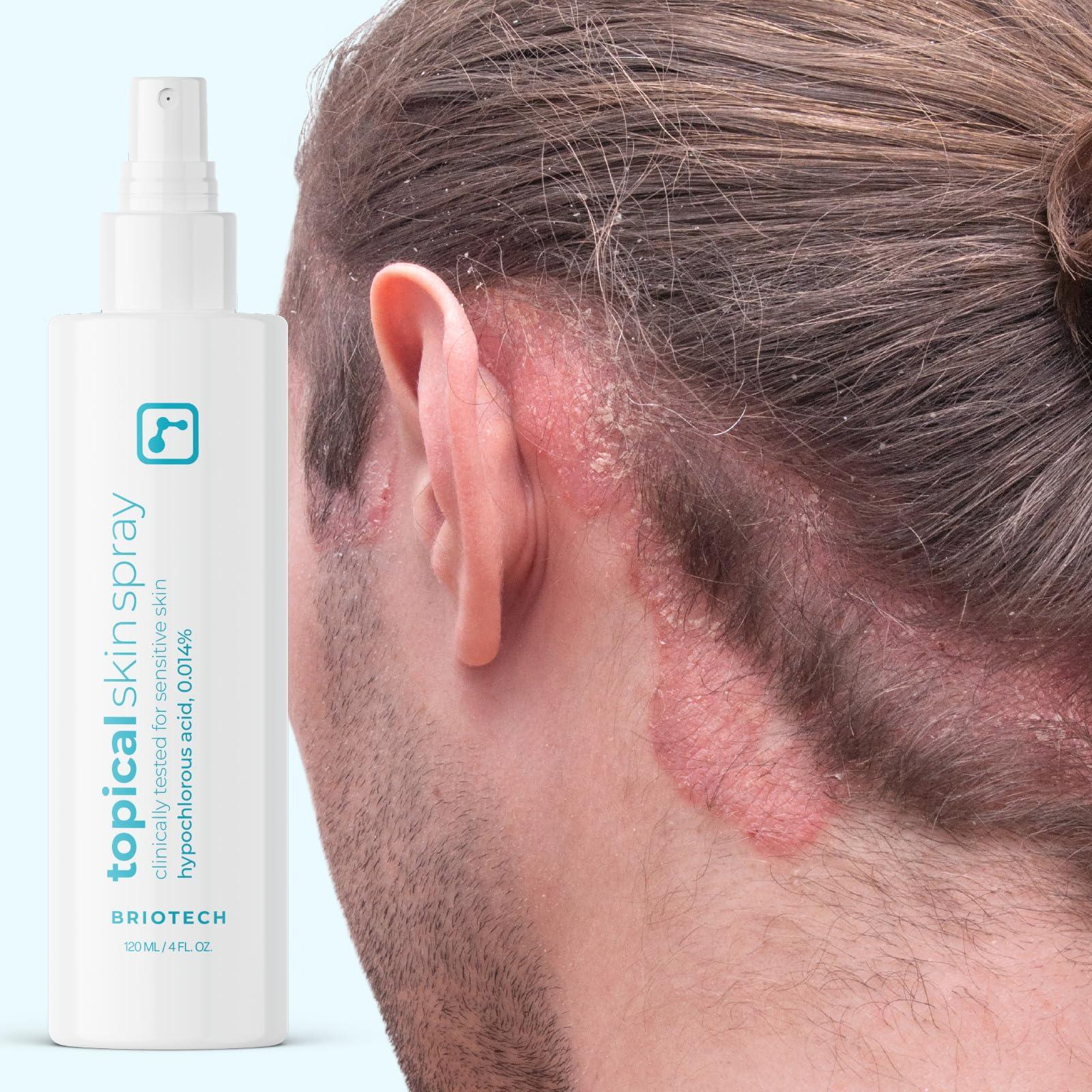BRIOTECH Topical Skin Spray, Hypochlorous Acid Spray for Body & Face, Eyelid Cleanser, HOCl Facial Mist, Support Against Irritation and Redness, Packaging May Vary, 4oz (1 Pack) - Image 8