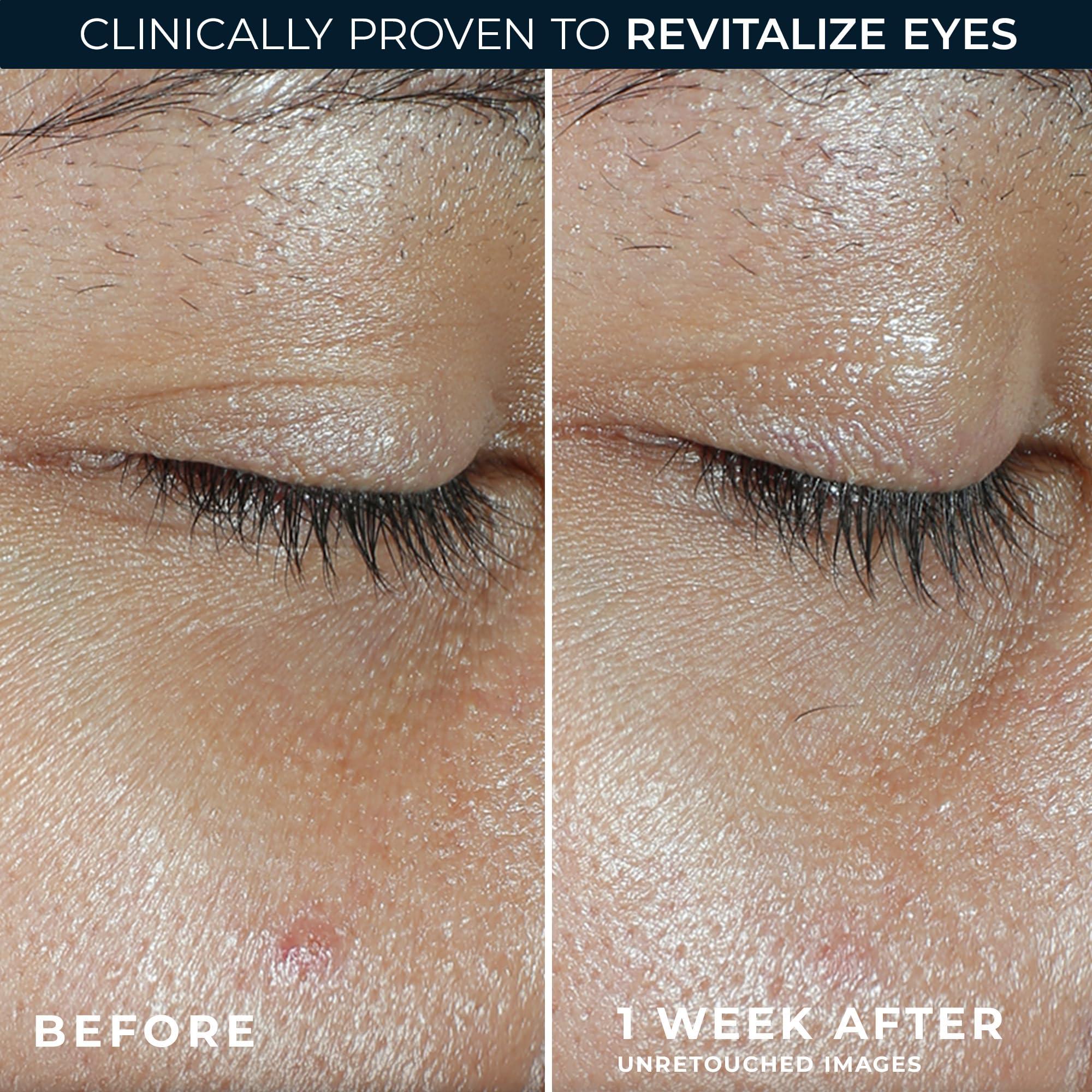 RoC Multi Correxion Revive + Glow Vitamin C Eye Balm (0.14 oz) with Retinol Eye Cream Packette - Image 4