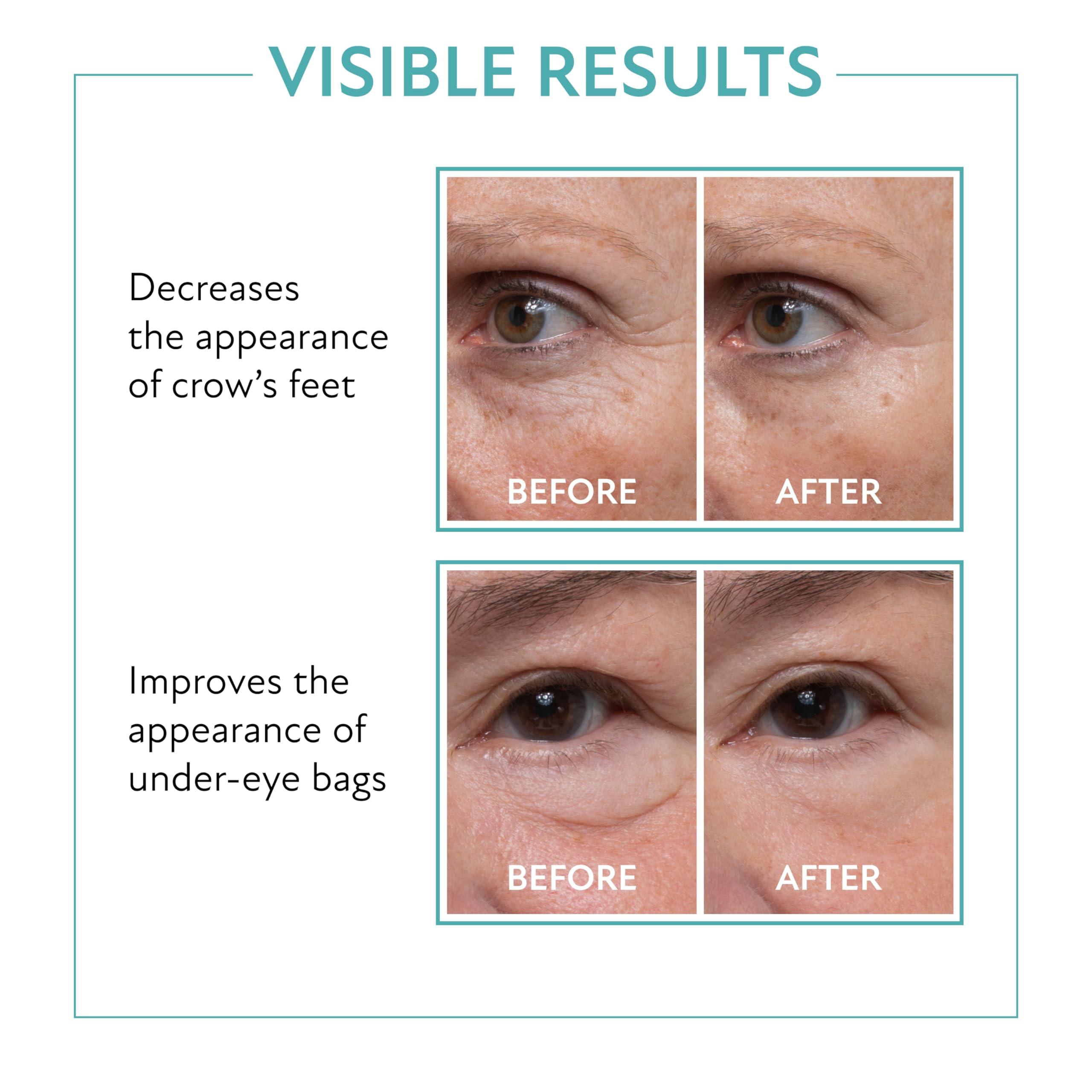 Westmore Beauty 60 Second Eye Effects Tinted Firming Gel - Instant Tightening Serum, Under-Eye Cream for Puffiness and Bags - Light to Medium, 0.33 Fl Oz (10 mL) - Image 2