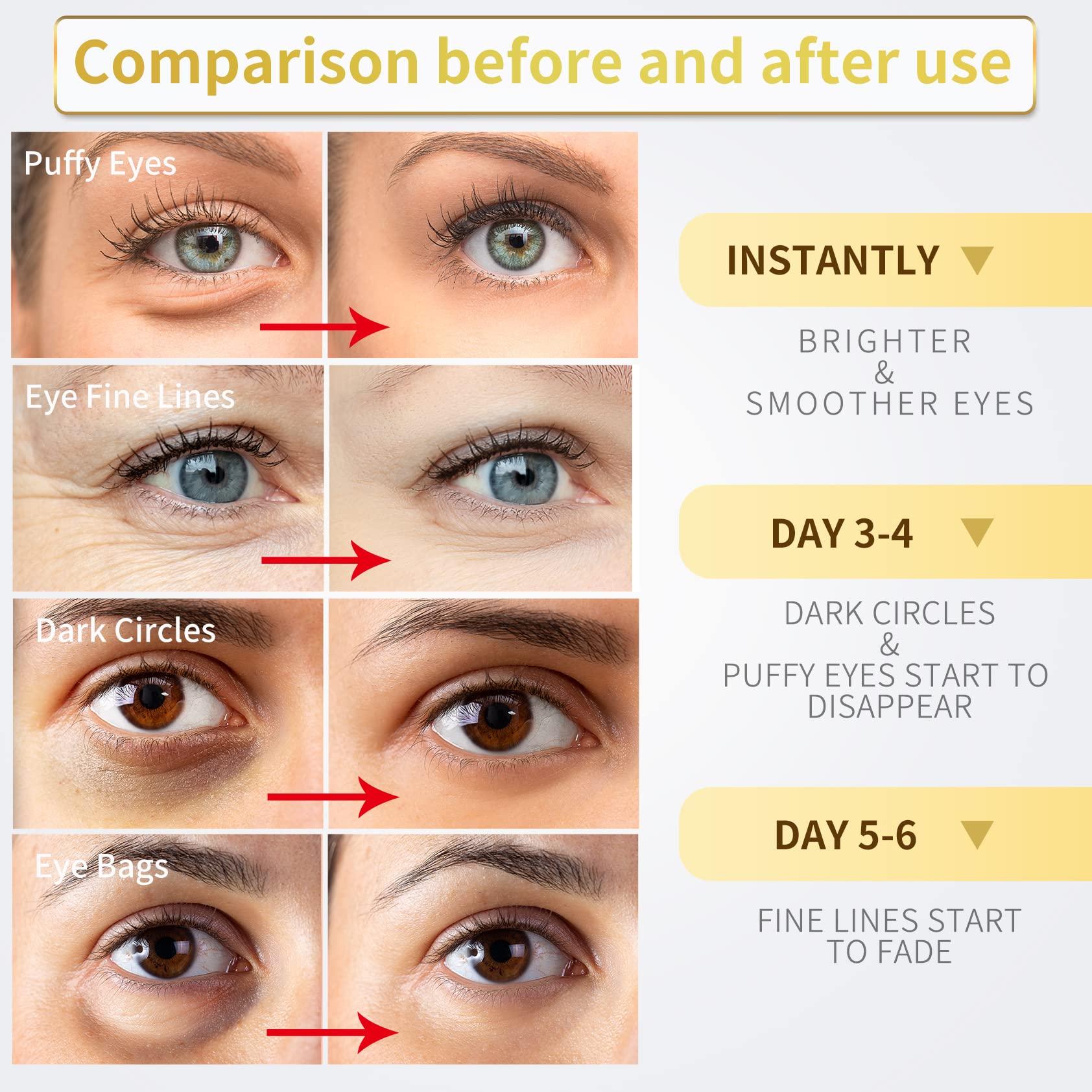 NAZANO 24K Gold Under Eye Patches - 60 Pack for Puffy Eyes, Dark Circles, Bags & Wrinkles with Collagen & Hyaluronic Acid - Image 3