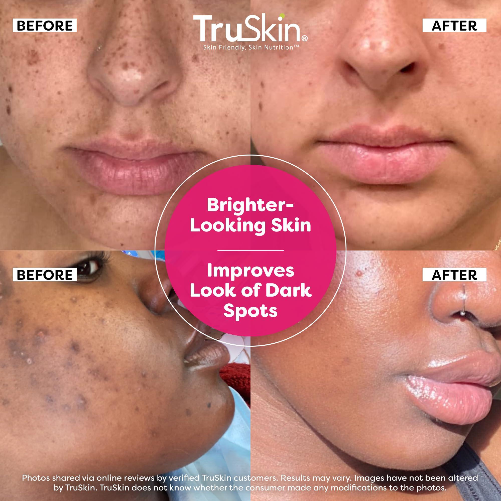 TruSkin Vitamin C Super Serum - Niacinamide, Retinol, Hyaluronic & Salicylic Acid - All-in-One Anti Aging Serum for Face – Improve Appearance of Dark Spots, Firmness for Brighter Looking Skin, 1 Fl Oz - Image 2