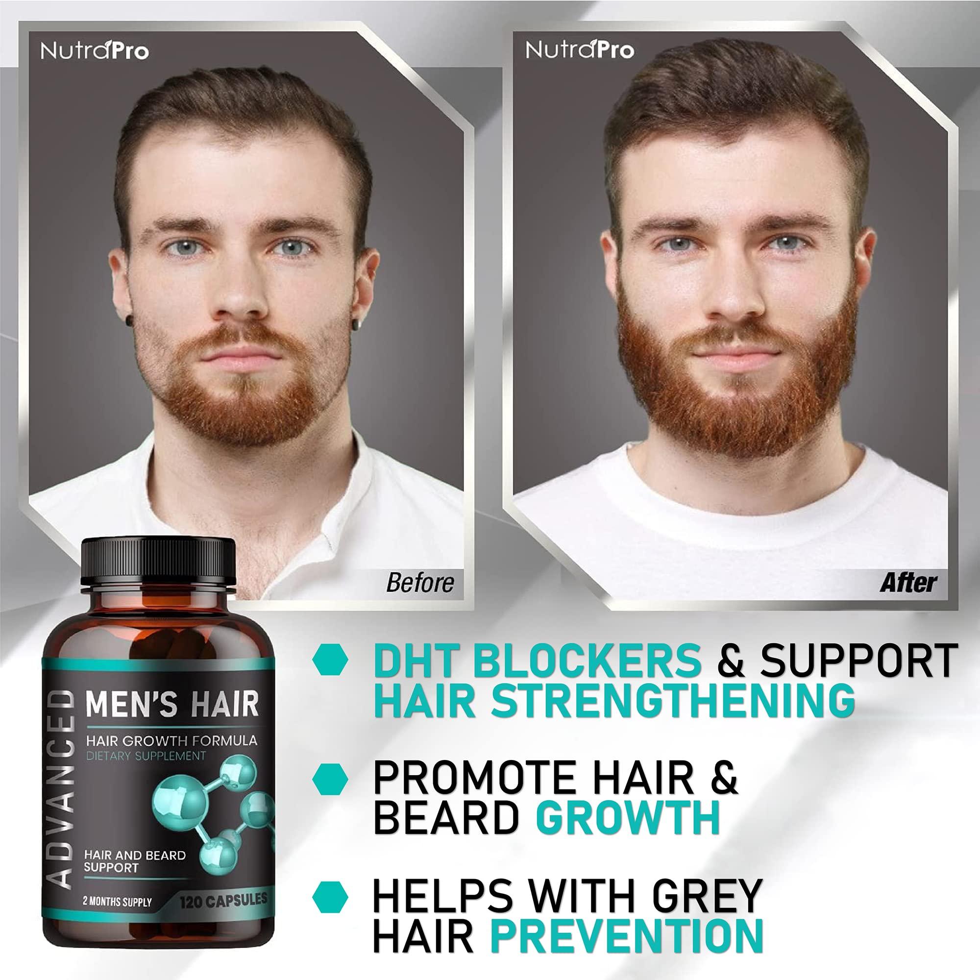 Hair Growth Vitamins For Men - Anti Hair Loss Pills. Regrow Hair & Beard Growth Supplement For Volumize, Thicker Hair.Stop Hair Loss And Thinning Hair With Biotin & Saw Palmetto Hair Vitamins.120 Caps - Image 3