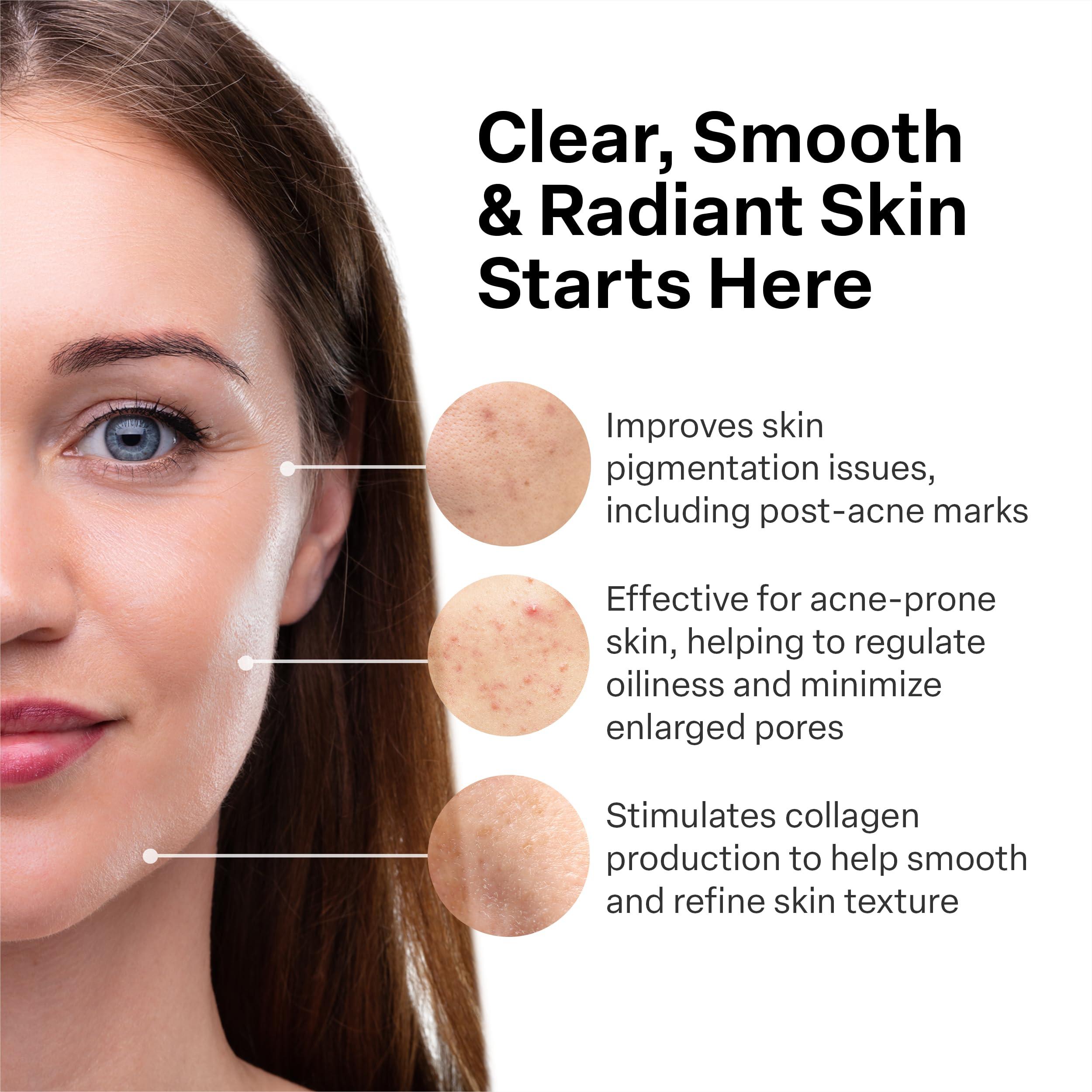 A313 French Pharmacy Vitamin A (Retinoids) Lightweight Face Cream for Anti-Aging, Reduce Wrinkles, Prevents Acne Breakouts, and Hyperpigmentation - Skincare for Smooth, Radiant Skin - 50g Cream - Image 3