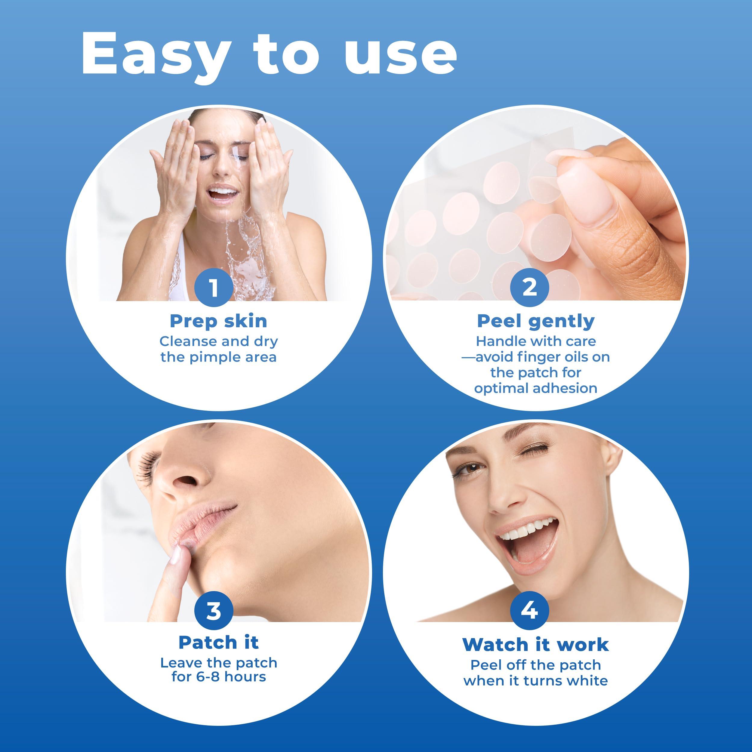 PatchRx Cold Sore Patches for Lips (20 Patches) Lysine, Calendula & Zinc – Hydrocolloid Cold Sore Patch for Lip Treatment (Overnight or Day-time Remedy), Fever Blister Patches - Image 4