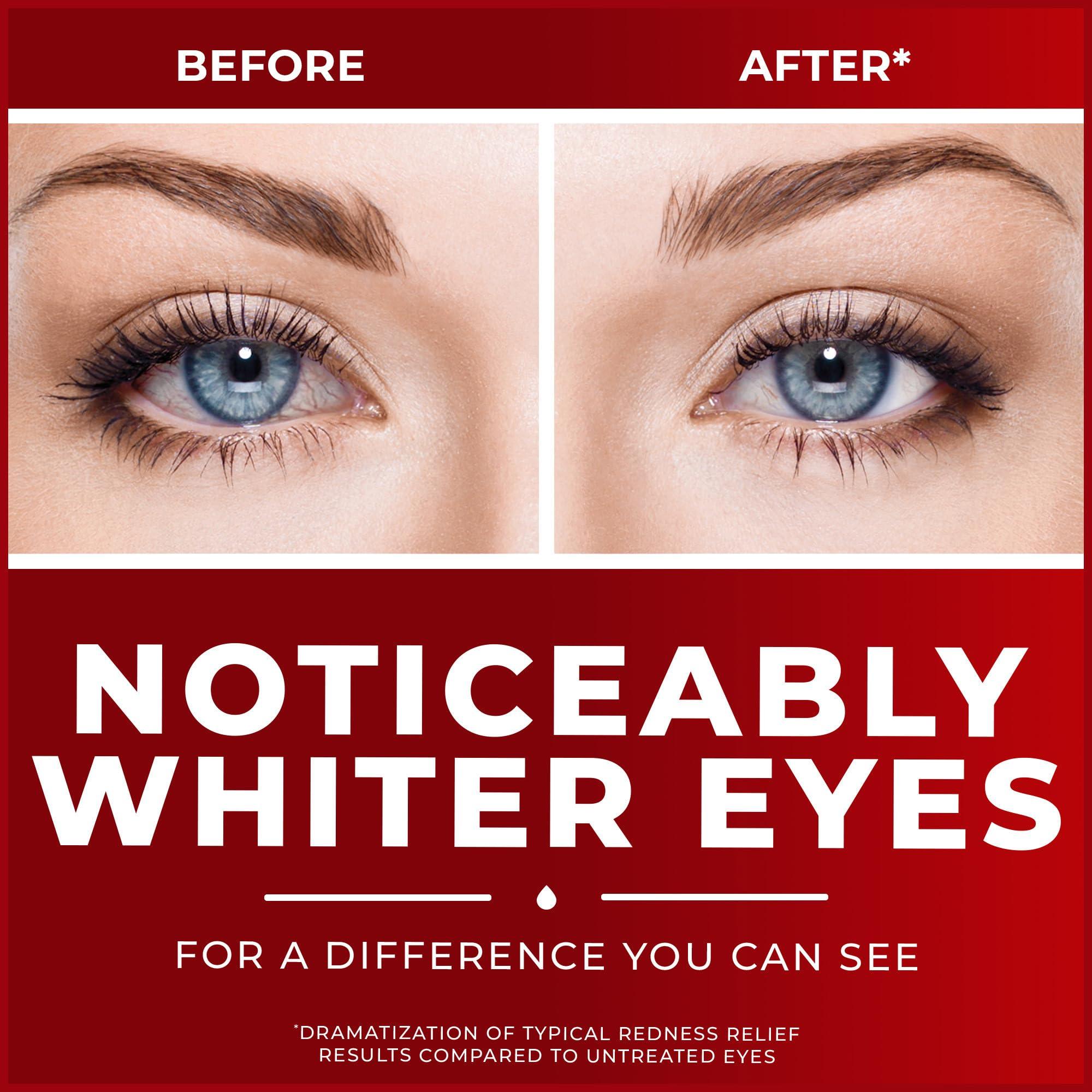 Clear Eyes | Maximum Redness Relief Eye Drops | 0.5 FL OZ - Image 4