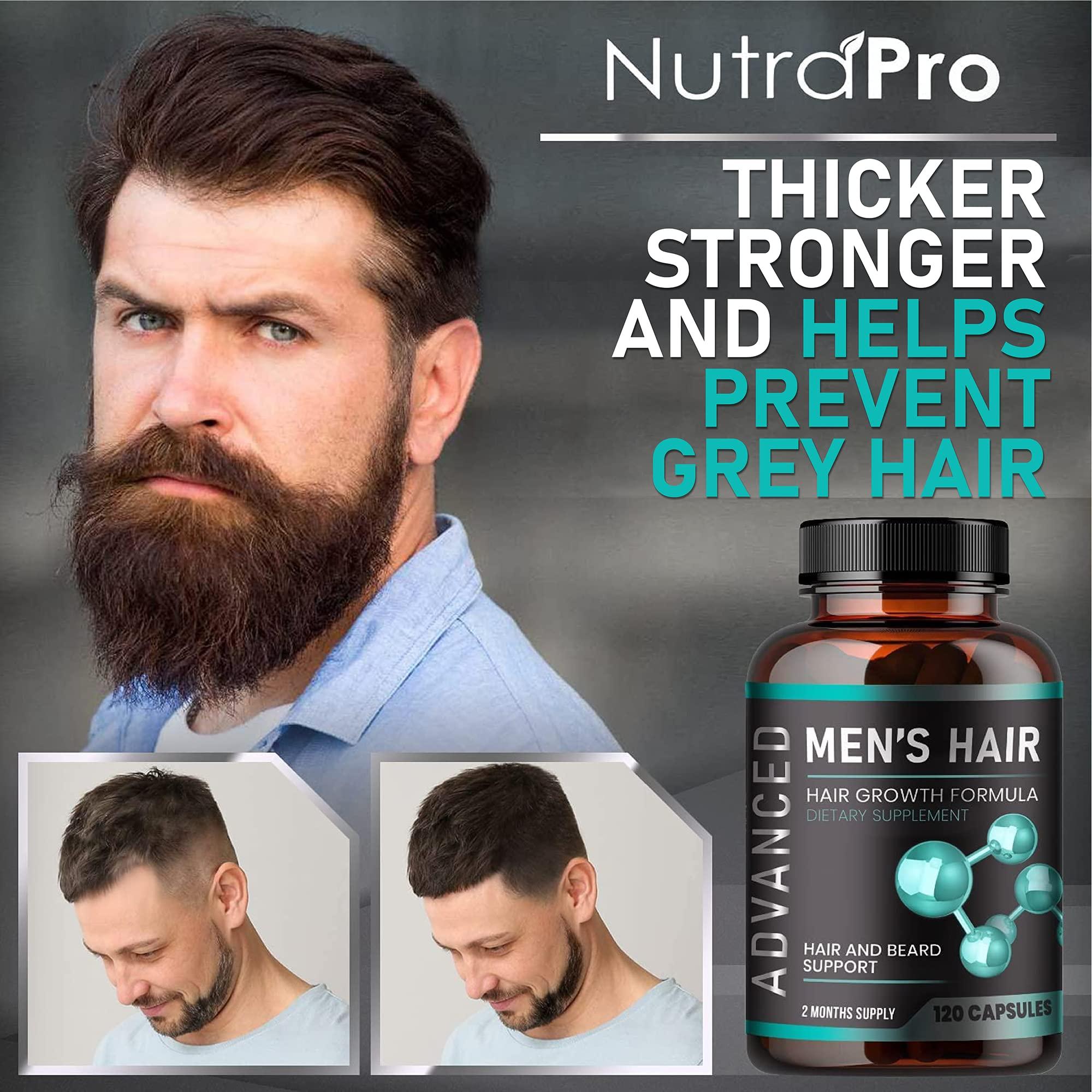 Hair Growth Vitamins For Men - Anti Hair Loss Pills. Regrow Hair & Beard Growth Supplement For Volumize, Thicker Hair.Stop Hair Loss And Thinning Hair With Biotin & Saw Palmetto Hair Vitamins.120 Caps - Image 2