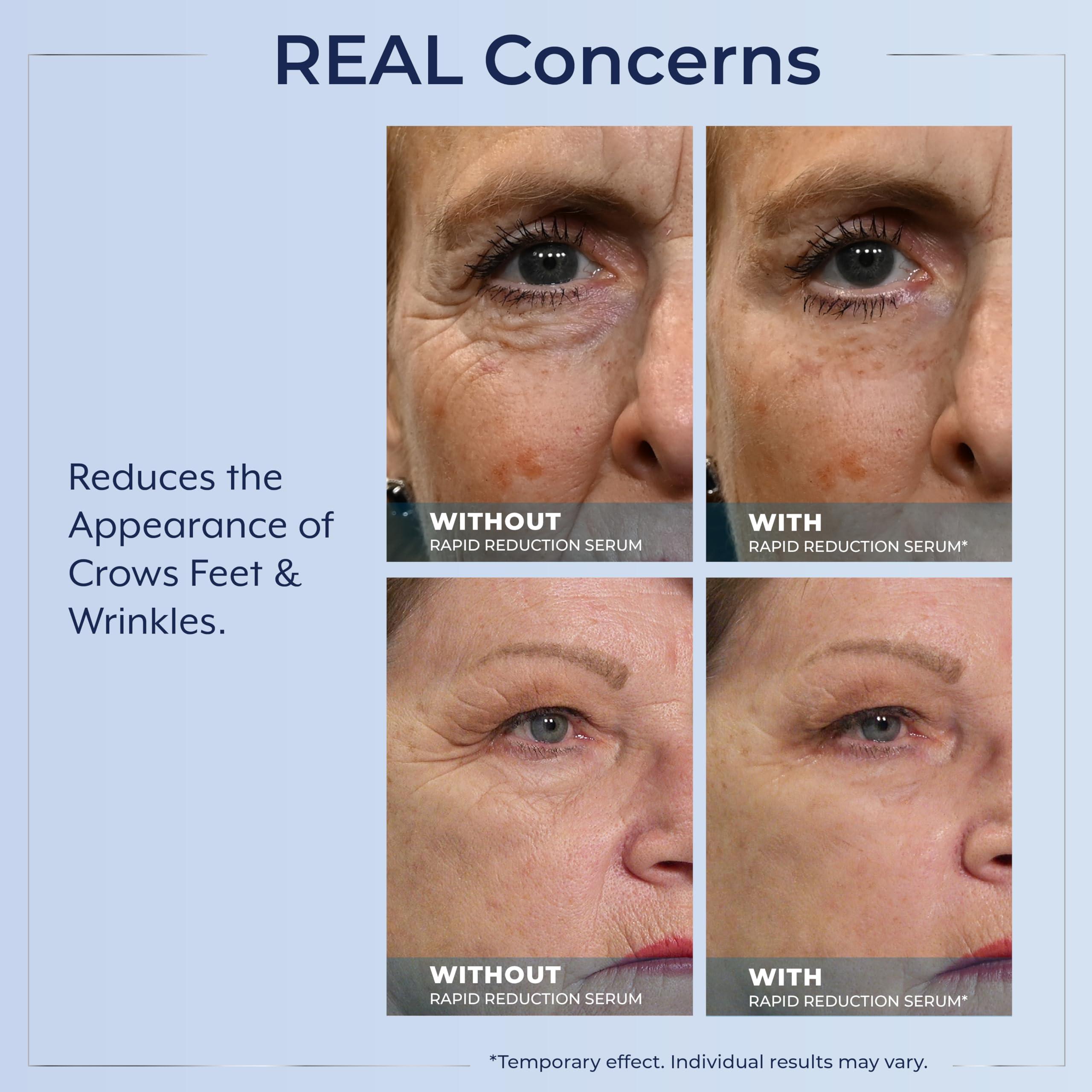 Plexaderm Rapid Reduction Eye Serum - Visibly Reduces Under-Eye Bags, Wrinkles, Dark Circles, Fine Lines & Crow's Feet Instantly, Anti Aging Wrinkle Remover for Face, Pump - Image 5