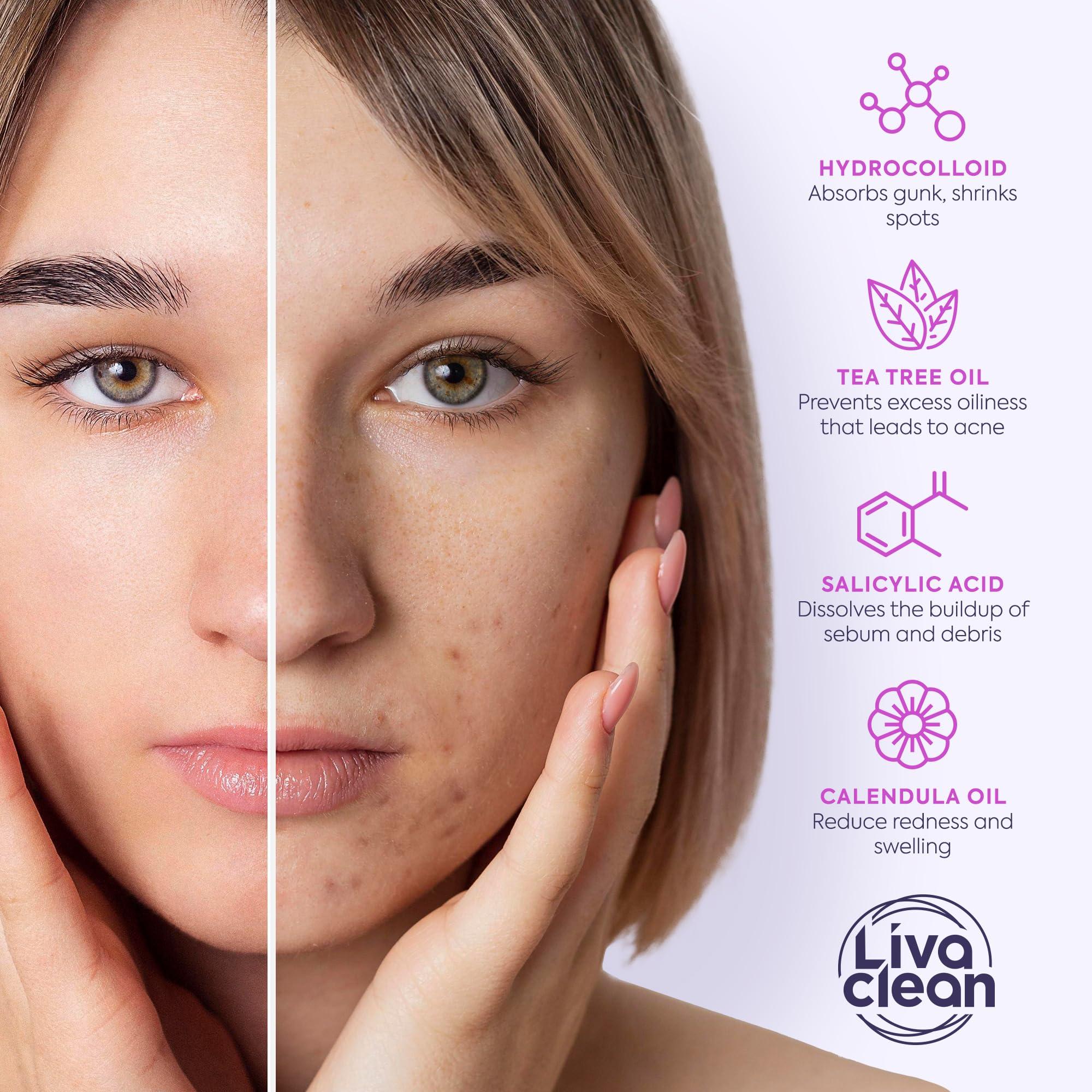 LivaClean 330 CT Pimple Patches for Face w/Salicylic Acid, Tea Tree Oil & Calendula Oil - Four Sizes - Pimple Patch, Hydrocolloid Patch, Acne Patches for Face - Image 6
