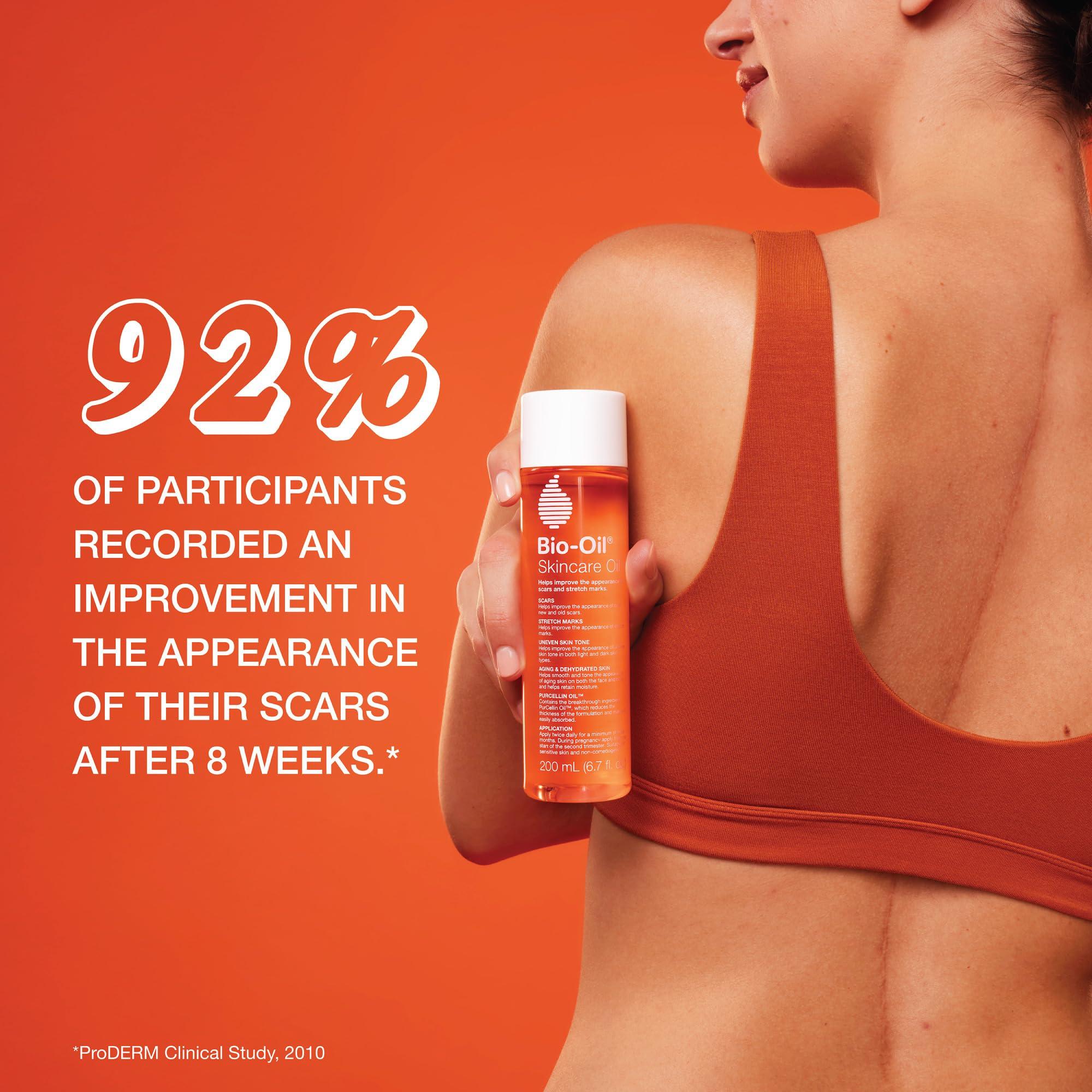 Bio-Oil Skincare Body Oil Serum, Face and Body Moisturizer with Vitamin E & A, for Scars, Stretch Marks, Sensitive Skin, All Skin Types, Dermatologist Recommended, Non-Comedogenic, 6.7 Oz - Image 3