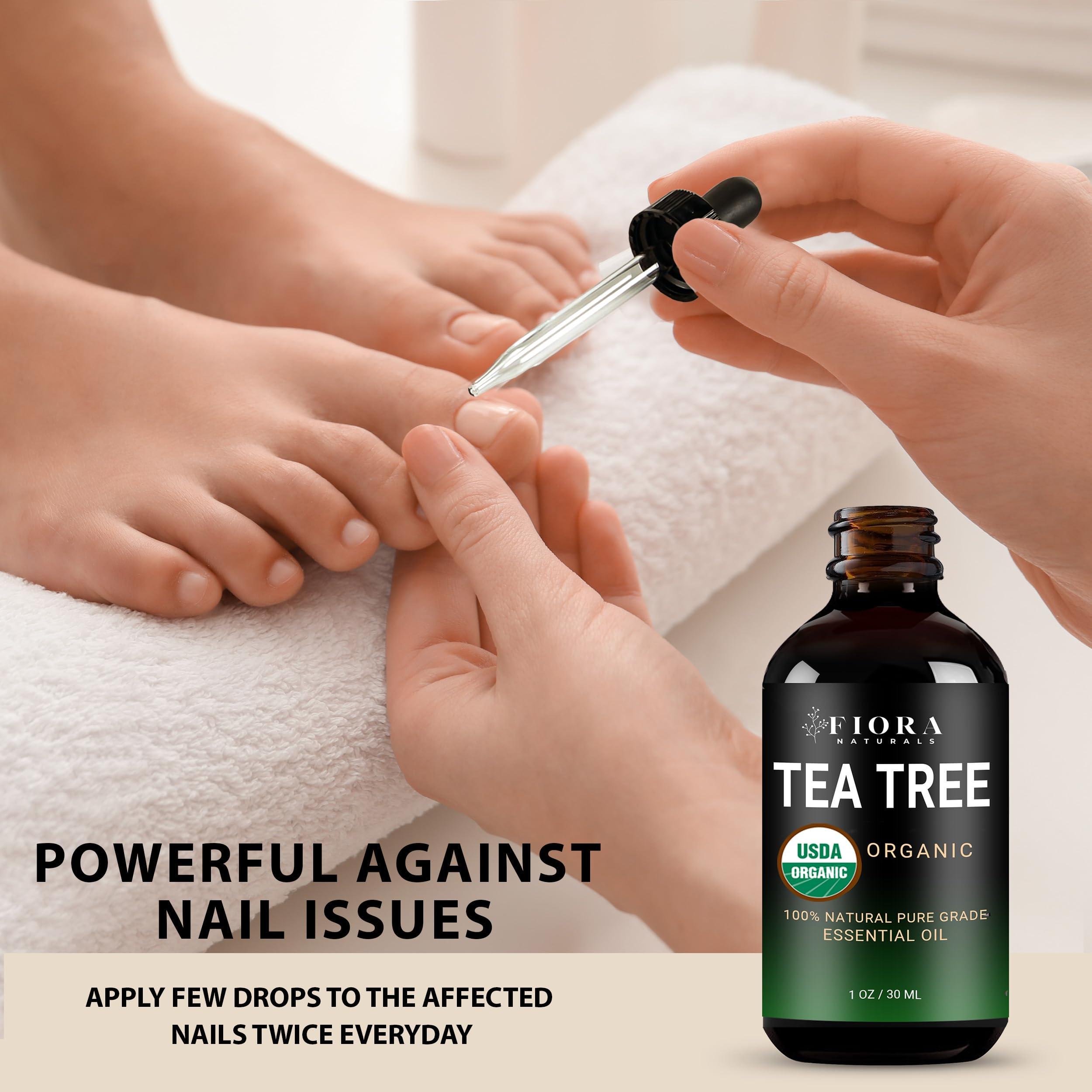 Tea Tree Essential Oil by Fiora Naturals- 100% Pure Organic Oil, for Face, Hair, Skin, Acne, Scalp, Foot and Toenails. Melaleuca Alternifolia, 1 oz /30ml - Image 5