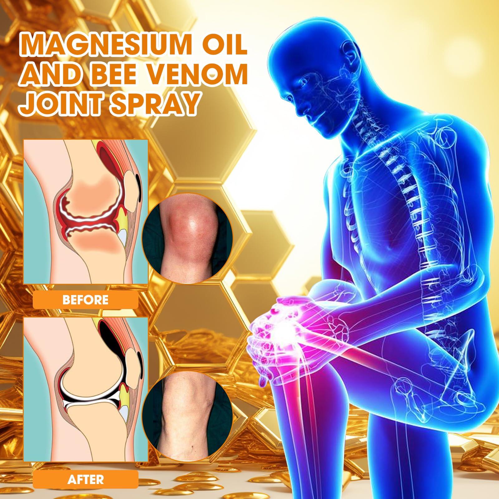 Magnesium Joint Spray, Professional Magnesium Joint Oil,Magnesium Oil & Bee Venom Joint Spray for Back, Knee, Hands, Neck （1 PCS,100ml） - Image 5