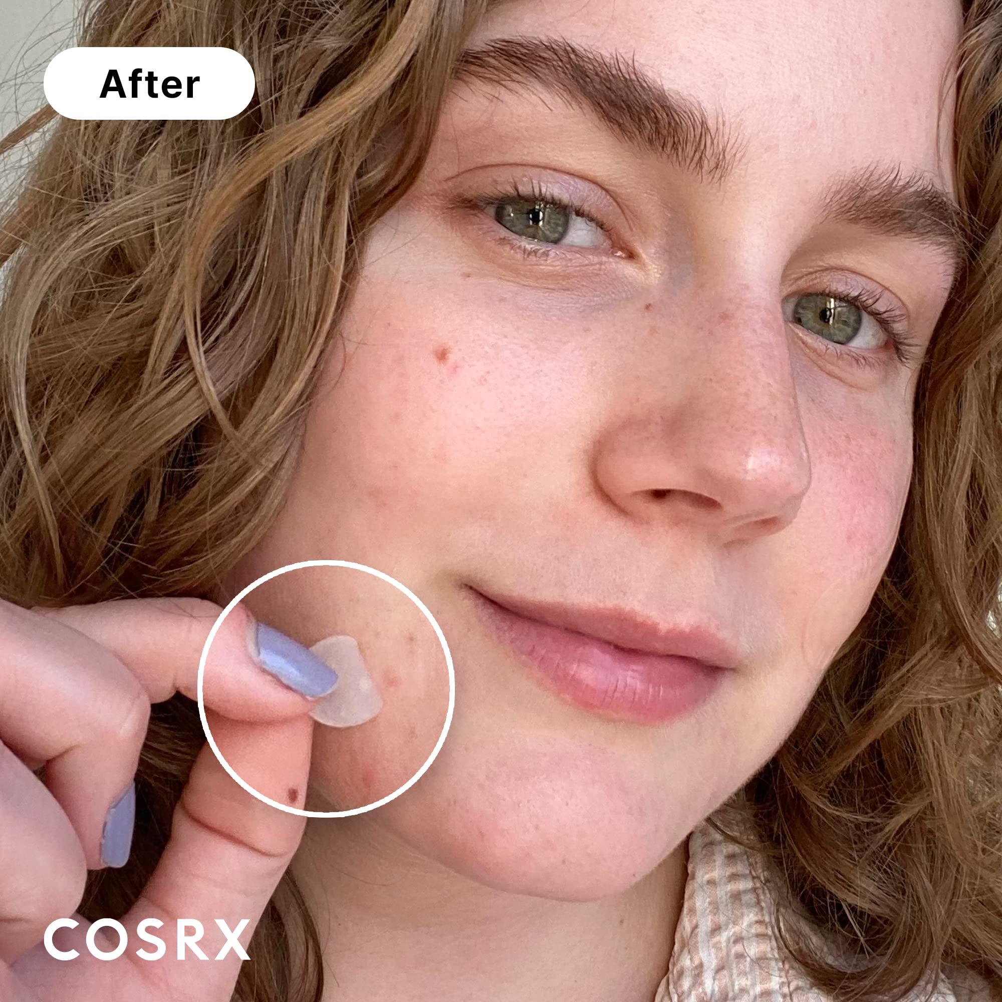 COSRX Acne Pimple Patch Absorbing Hydrocolloid Original 3 Size Patches for Blemishes and Zits Cover, Spot Stickers for Face and Body, Not Tested on Animals (72) - Image 2