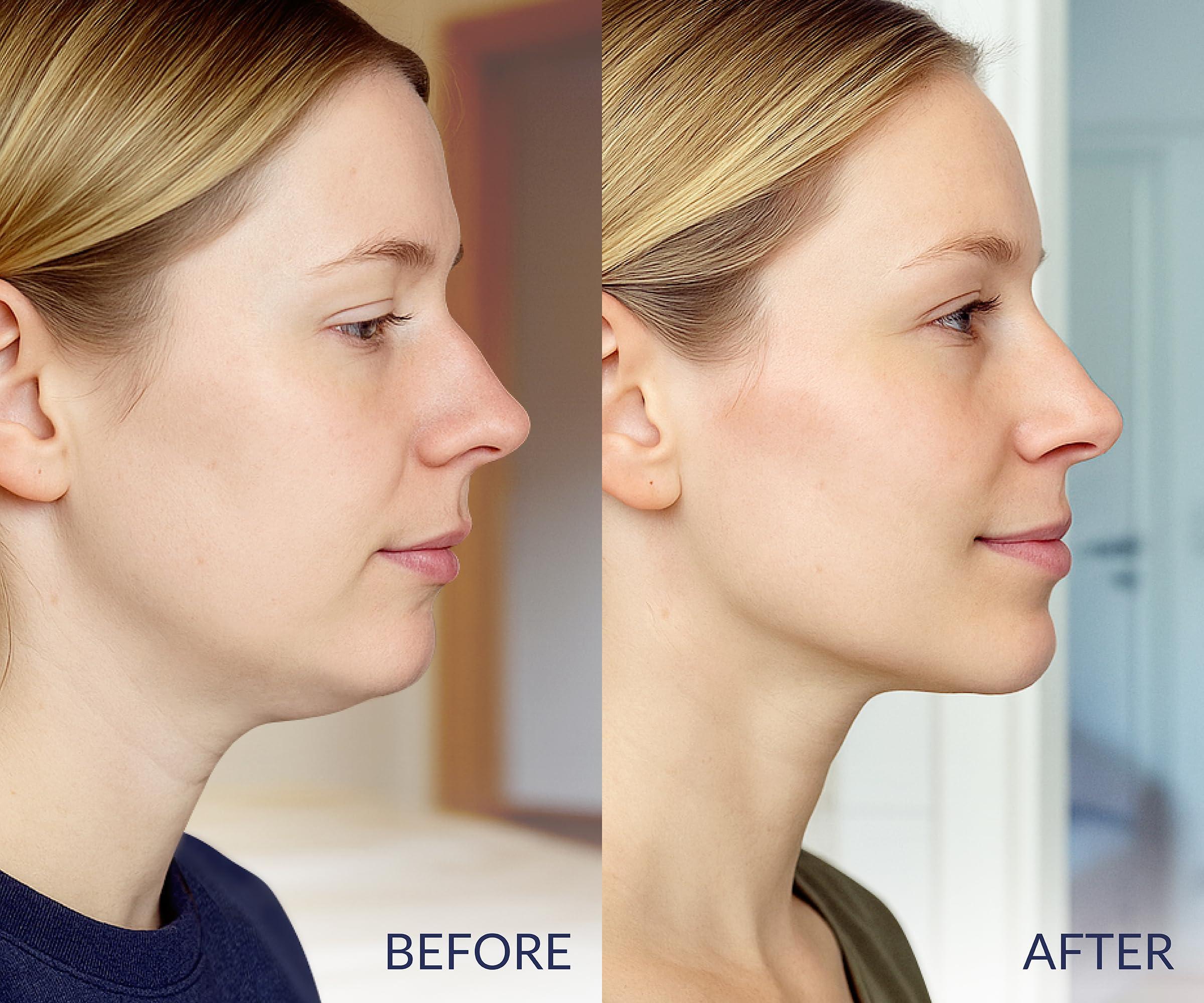 Stylia V Line Lifting Collagen Face Mask - Double Chin Strap for Women - Jawline Shaper Face Lift Tape - Neck Lift Collagen Mask - Chin Strap for Sleeping - Hyaluronic Acid, Aloe Vera, Cica 7PC - Image 2