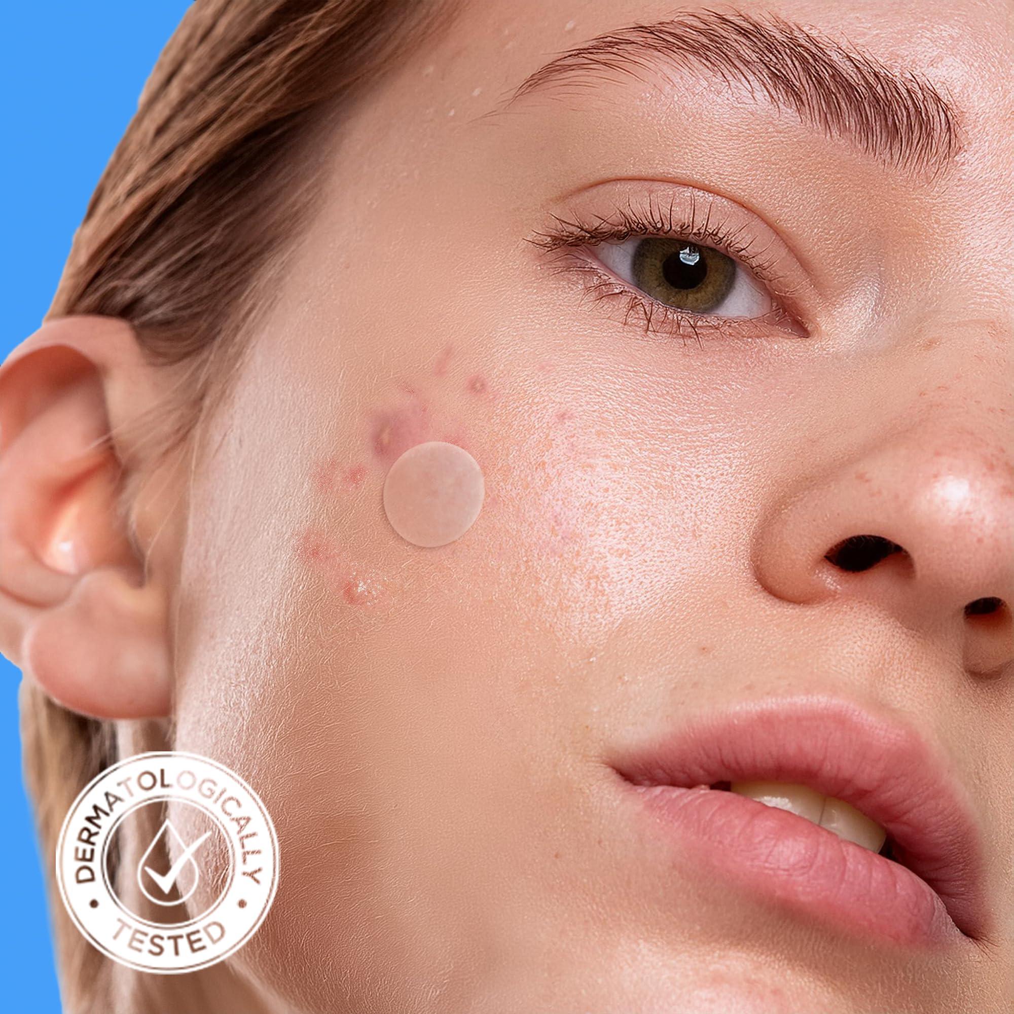 AVARELLE Acne Cover Patches, FSA HSA Eligible Hydrocolloid Pimple Patches for Face with Tea Tree Oil, Korean Skincare Zit Patches for Face | FSA HSA Store Eligible Items | Vegan, Cruelty-free - Image 8