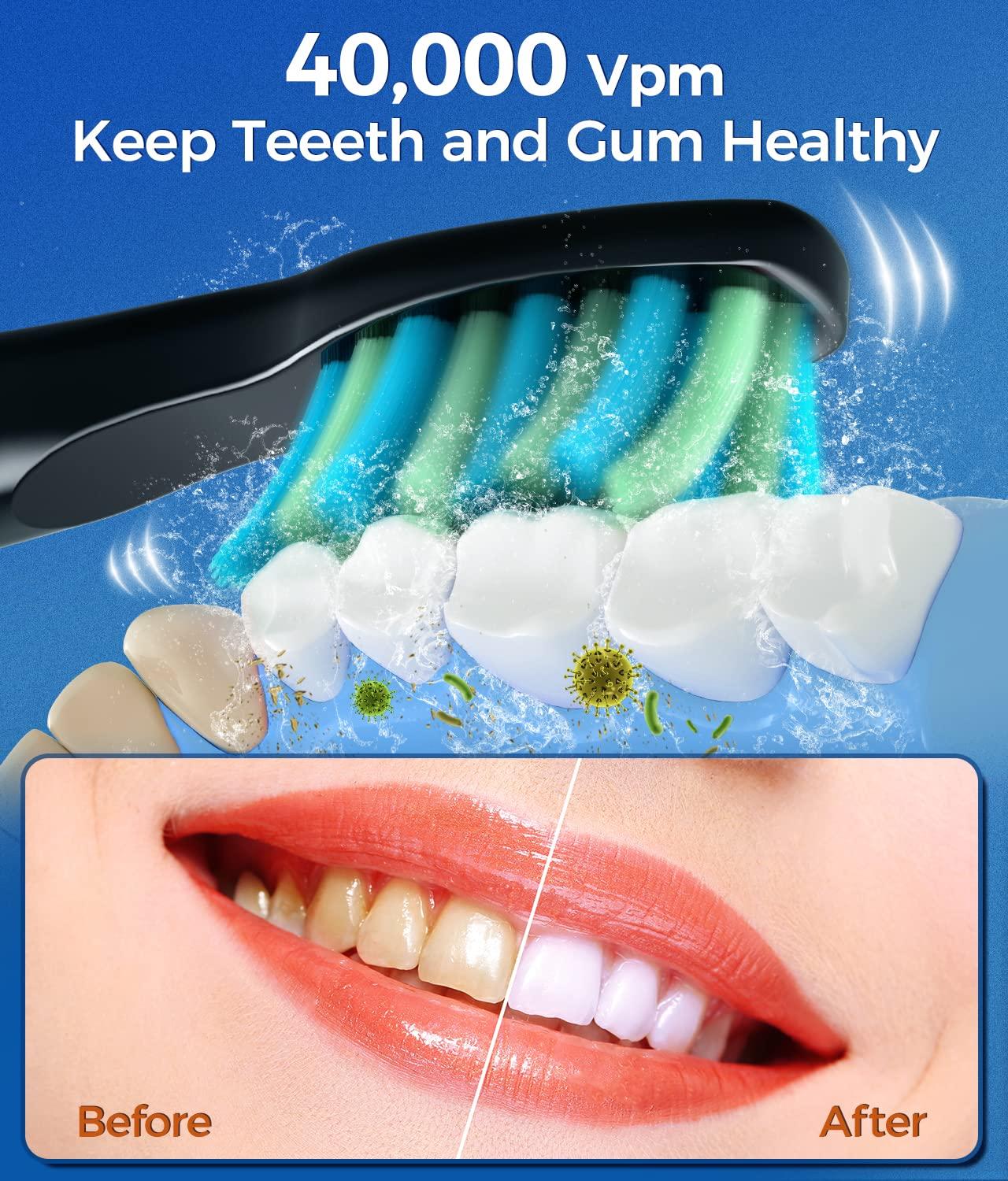 TEETHEORY Sonic Electric Toothbrushes for Adults and Kids, 8 Brush Heads Electric Toothbrush with 40000 VPM Deep Clean 5 Modes, Rechargeable Fast Charge 4 Hours Last 30 Days - Image 2