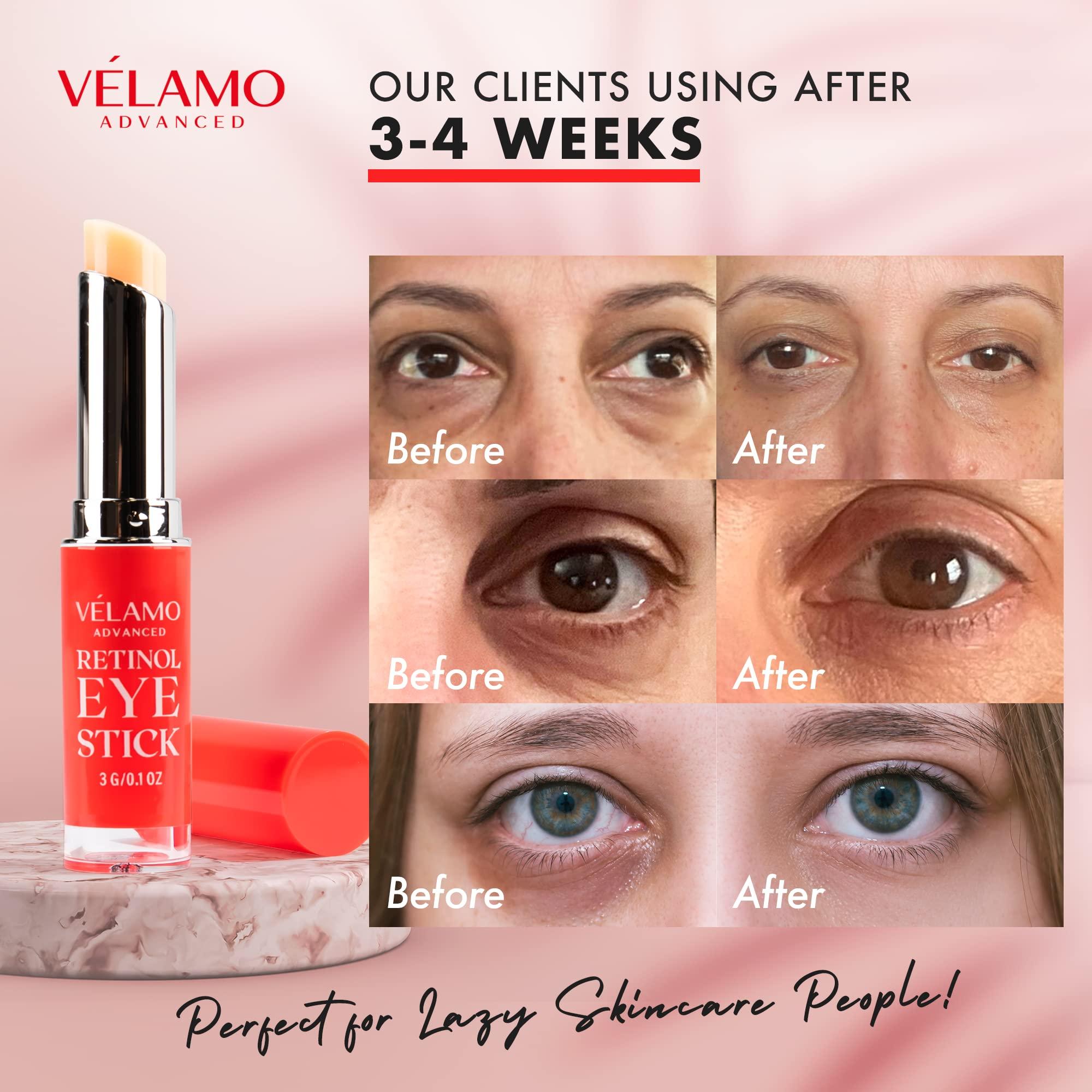 Retinol Eye Stick, Retinol Eye Cream, Retinol Cream, Retinol Face Cream, Under Eye Cream Anti Aging, Eye Cream, Brightening Eye Balm Reduces Fine Lines and Dark Circles, Visible Results in 3-4 Weeks - Image 5