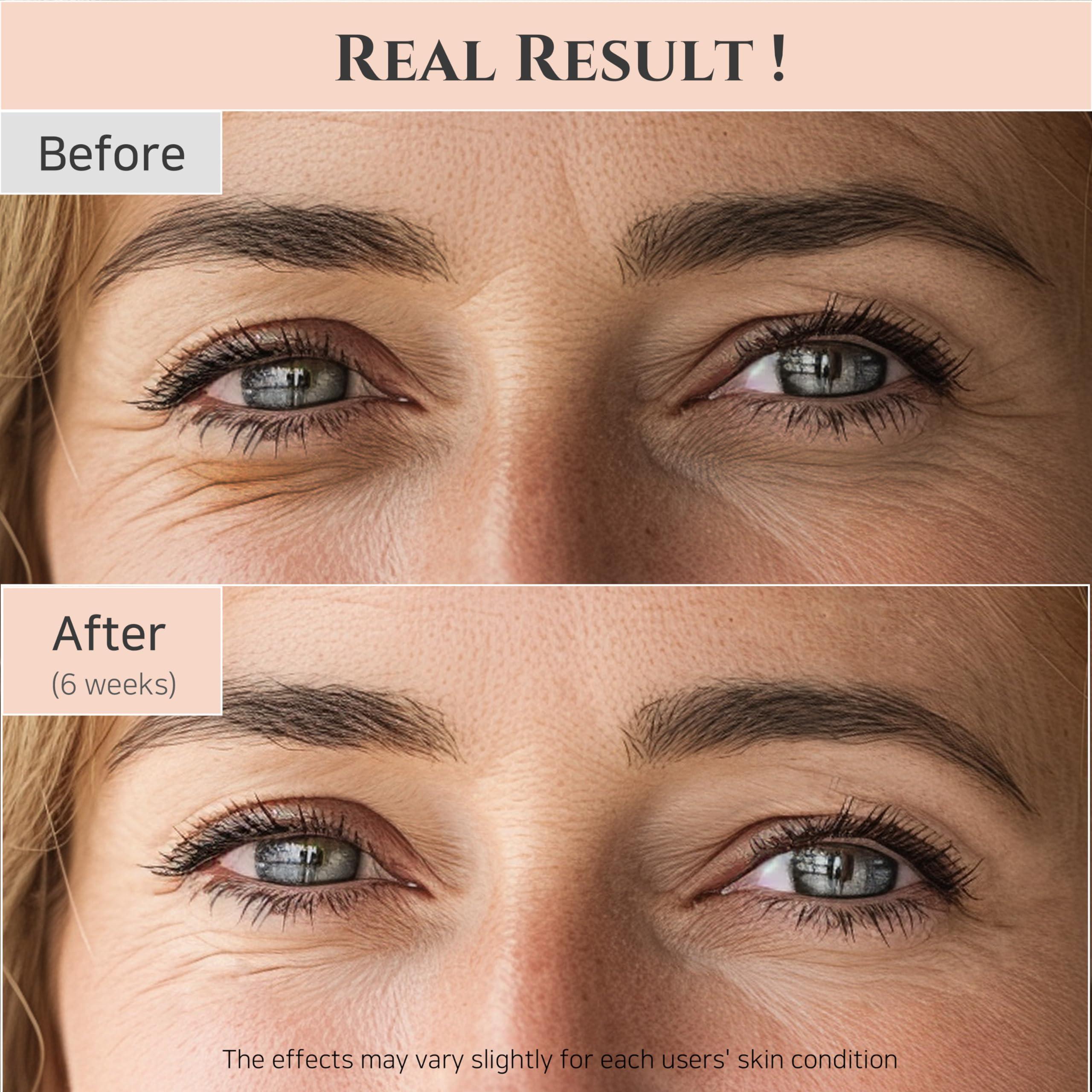 Beauty of Joseon Revive Eye Serum with Retinal Niacinamide Correction for Puffy Eye Bags Fine Lines Dark Circles Wrinkles, Korean Skin Care 30ml, 1 fl.oz - Image 3