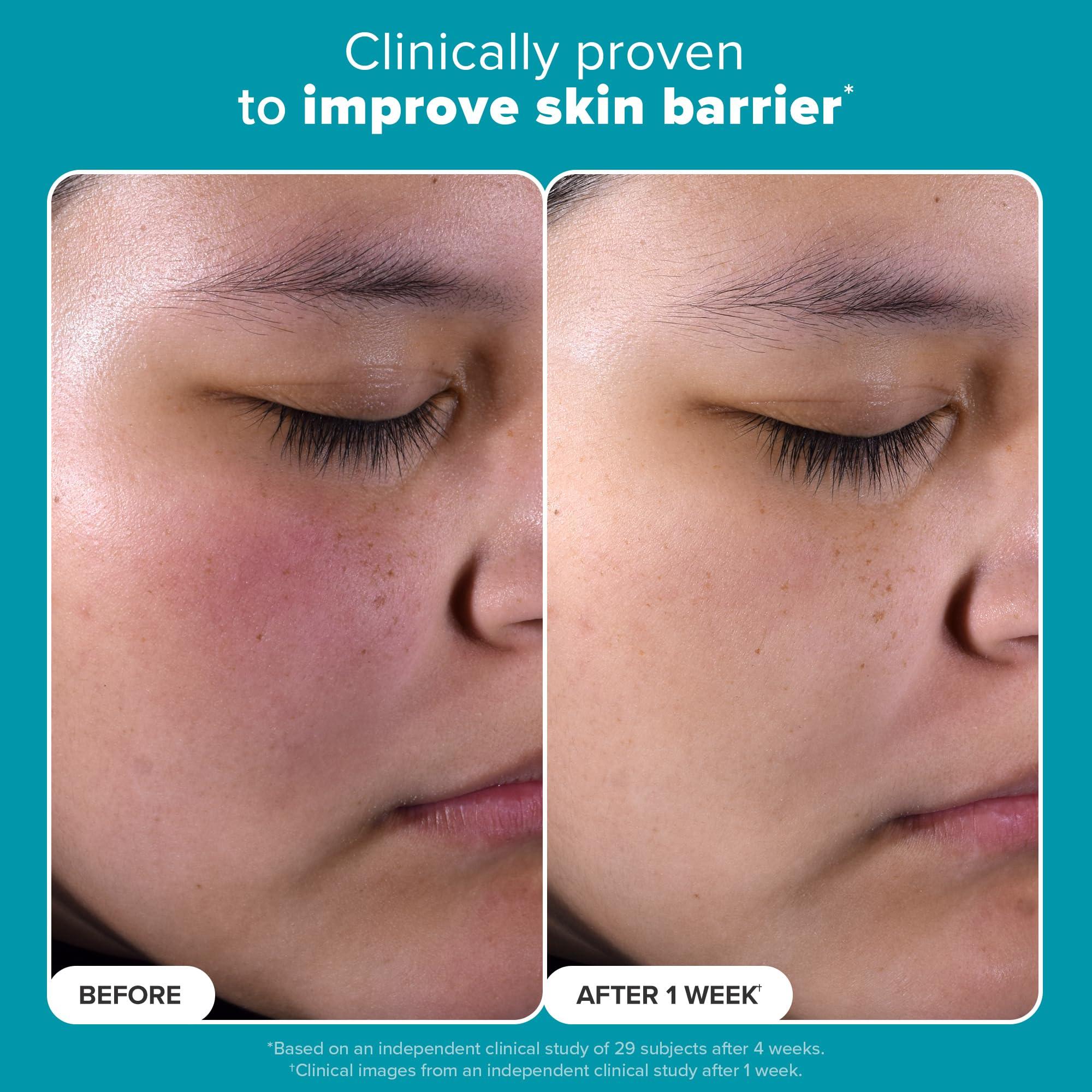 Paula's Choice SKIN PERFECTING 2% BHA Liquid Salicylic Acid Exfoliant-Facial Exfoliant for Enlarged Pores, Wrinkles & Fine Lines and Suitable for Blackhead-Prone Skin - Image 3