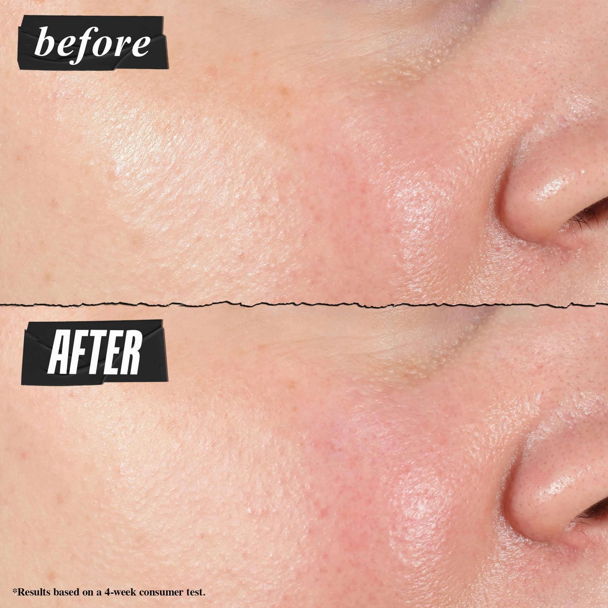 Kiehl's Hydro-Plumping Hydrating Serum, Plumps Skin, Improves Elasticity, Reduces Appearance of Dry Skin, Ophthalmologist and Dermatologist Tested, Fragrance-Free - Image 3