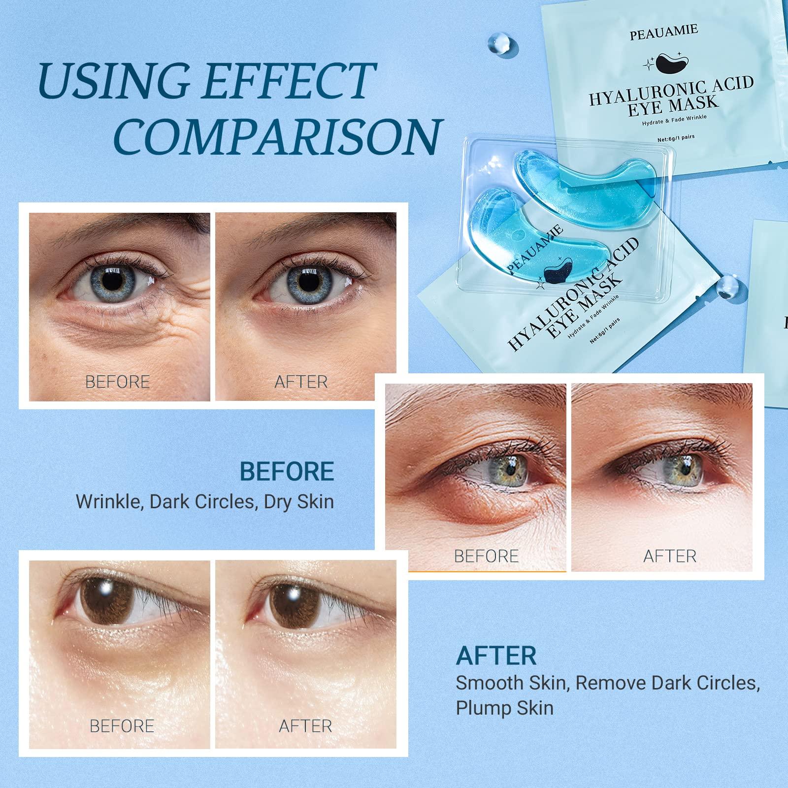 PEAUAMIE Under Eye Patchs Hyaluronic Acid Eye Mask for Dark Circles and Puffiness Wrinkle Eye Bags 30 Pairs - Image 4