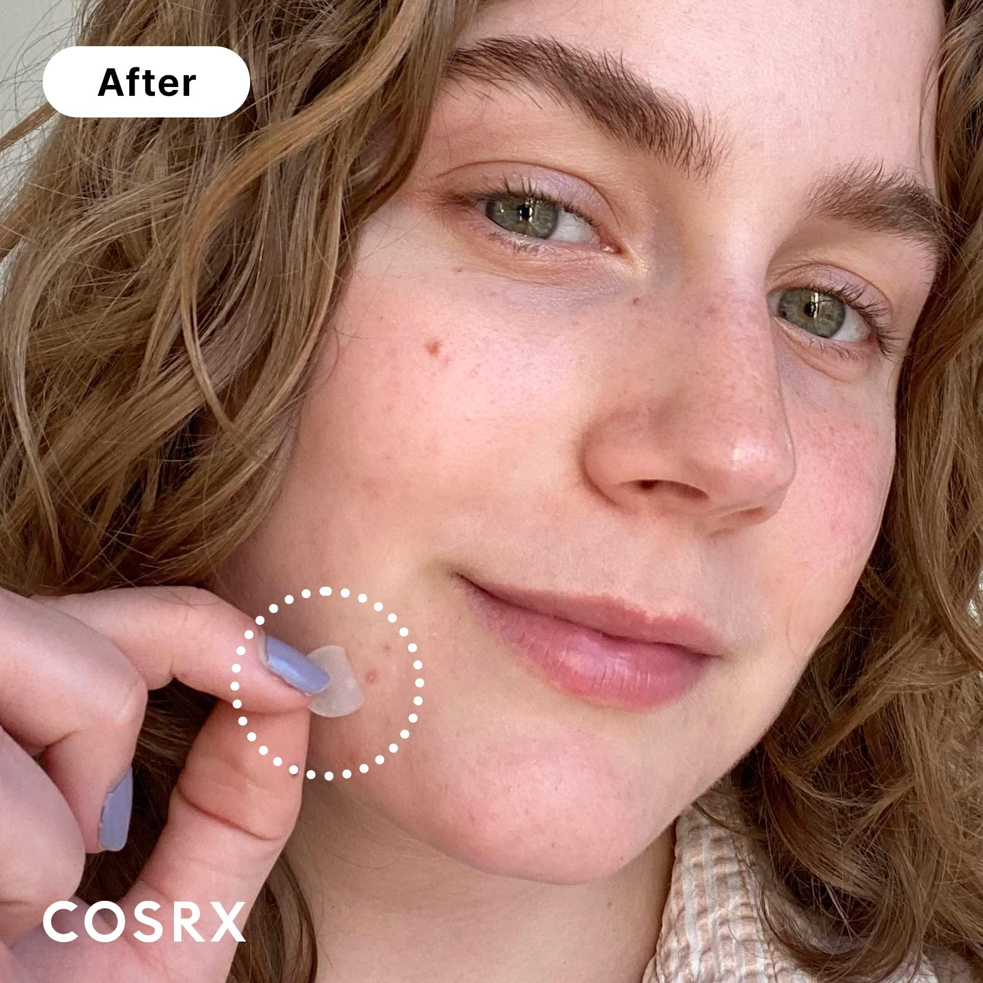 COSRX Acne Pimple Patch Absorbing Hydrocolloid Original 3 Size Patches for Blemishes and Zits Cover, Spot Stickers for Face and Body, Not Tested on Animals - Image 3