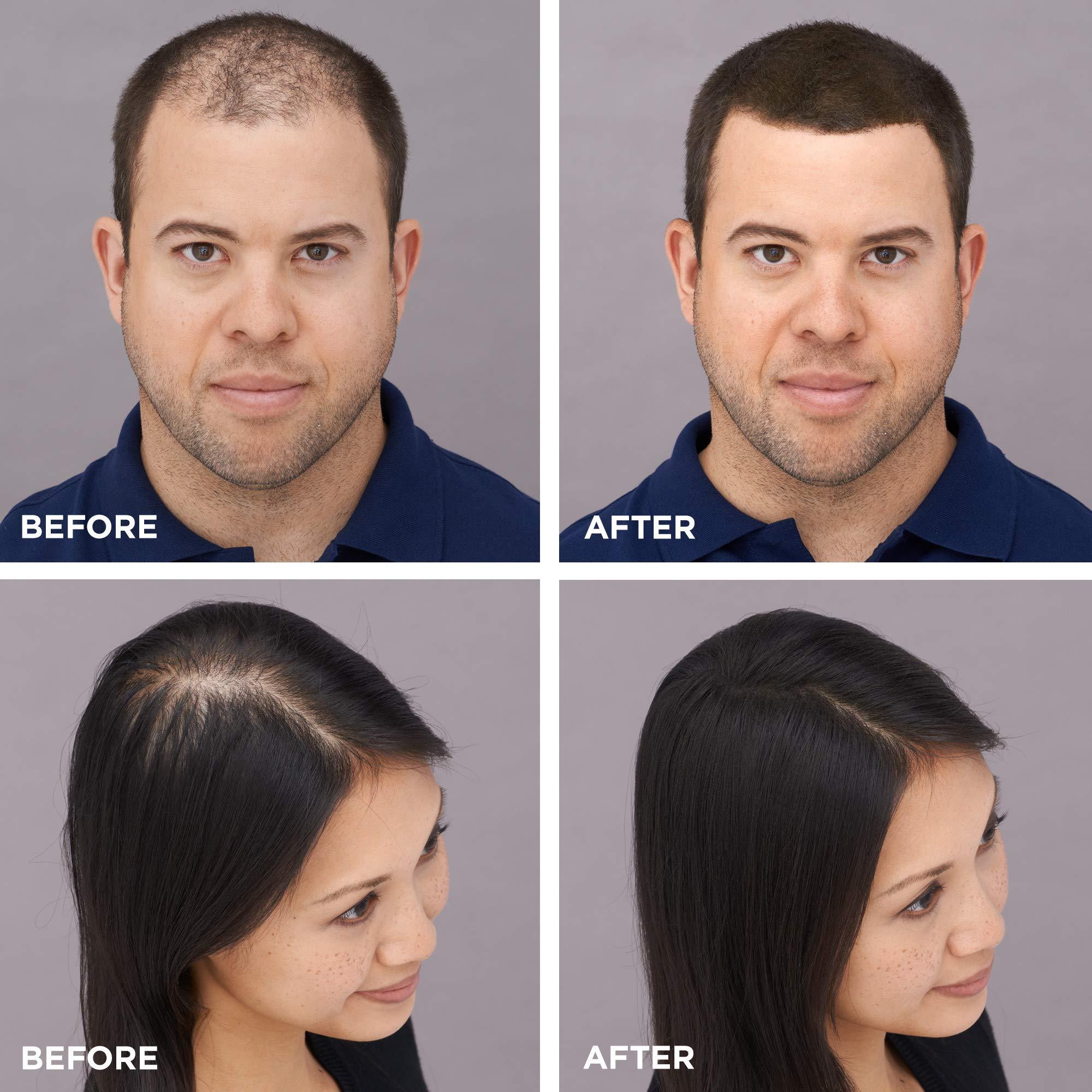 Toppik Hair Building Fibers, Fill In Fine or Thinning Hair Instantly Thicker, Fuller Looking Hair 9 Shades,4 size options - Image 12