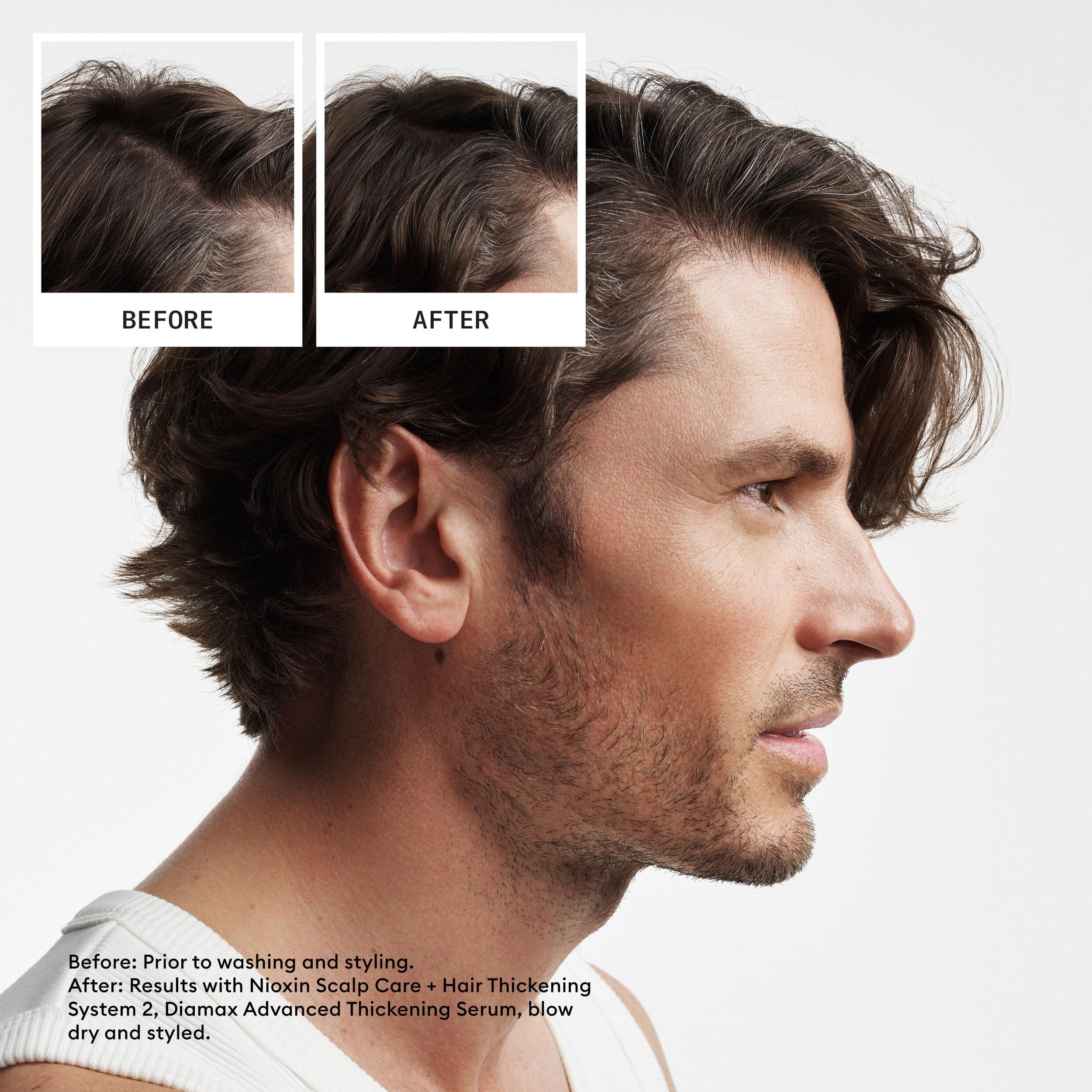 Nioxin Scalp + Hair Thickening System Kits | For Natural, Colored, & Damaged Hair with Light to Progressed Thinning | Strengthen & Boost Hair Density with Niacinamide & Biotin | 3 Month Supply - Image 3
