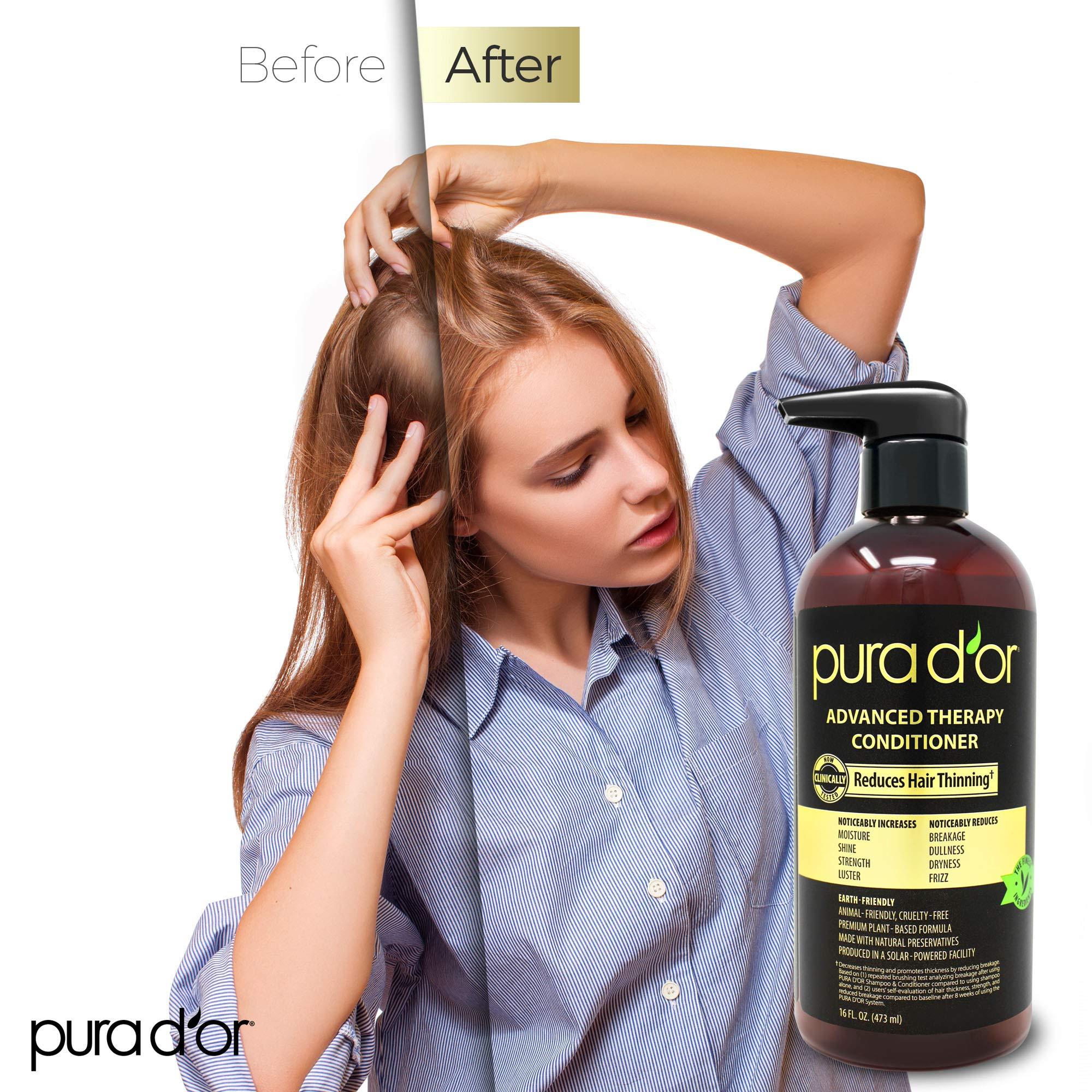 PURA D'OR Advanced Therapy Conditioner (16oz) For Increased Moisture, Strength, Volume & Texture, No Sulfates, Contains Argan Oil & Biotin, All Hair Types, Men & Women (Packaging May Vary) - Image 3