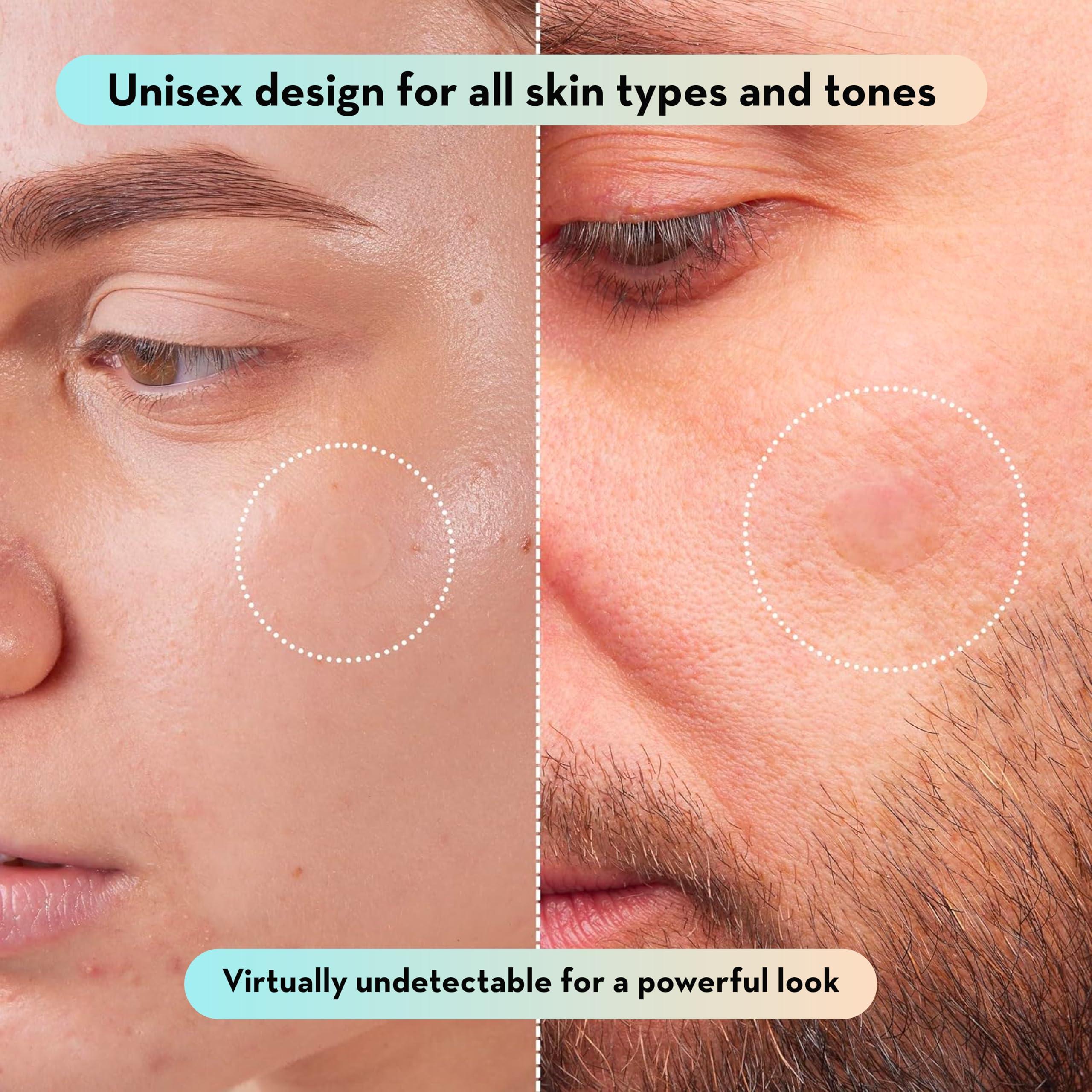 LE GUSHE Korean Pimple Patches for Face (132 Dots) - Hydrocolloid Acne Patches with Tea Tree Oil - Invisible Zit Stickers - Dermatologist Tested - Korean Skin Care - Image 8