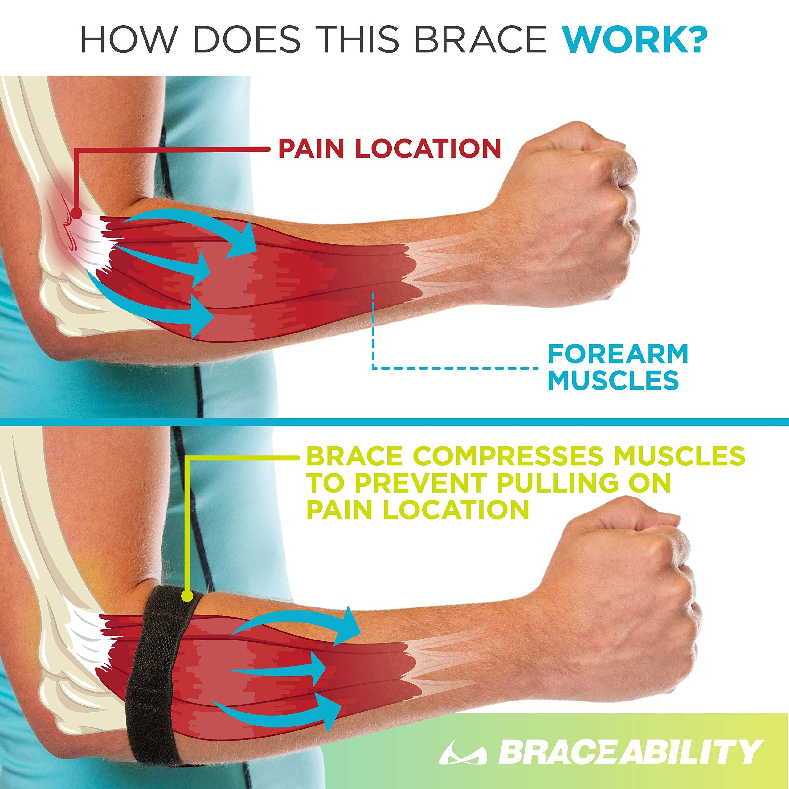 BraceAbility Epicondylitis Brace | Elbow Strap for Medial/Lateral Epicondyle Pain and Tendonitis Arm Compression Support Band for Men or Women (One Size Fits Most) - Image 4