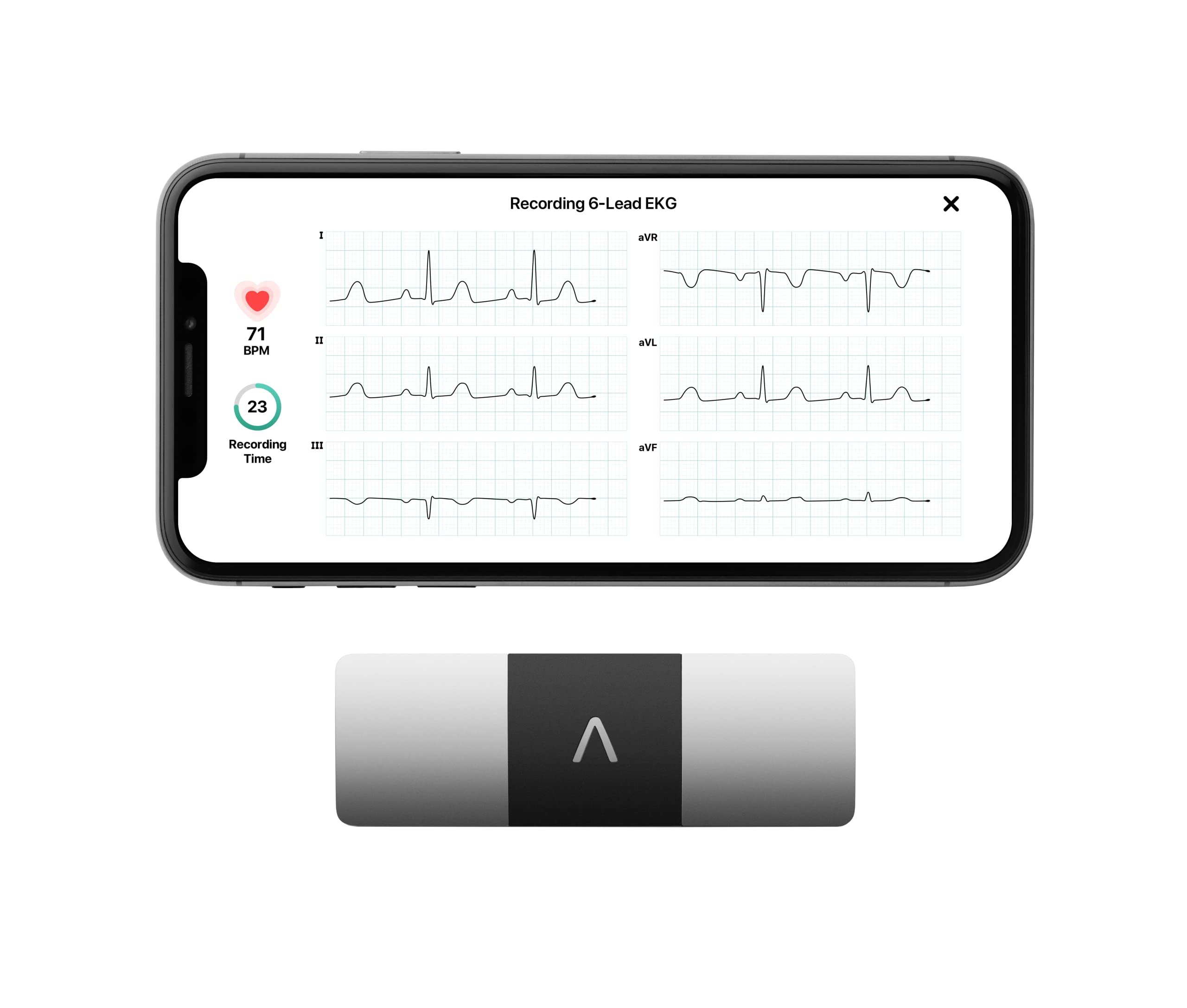 KardiaMobile 6-Lead Personal EKG Monitor – Six Views of The Heart – Detects AFib and Irregular Arrhythmias – Instant Results in 30 Seconds – Works with Most Smartphones