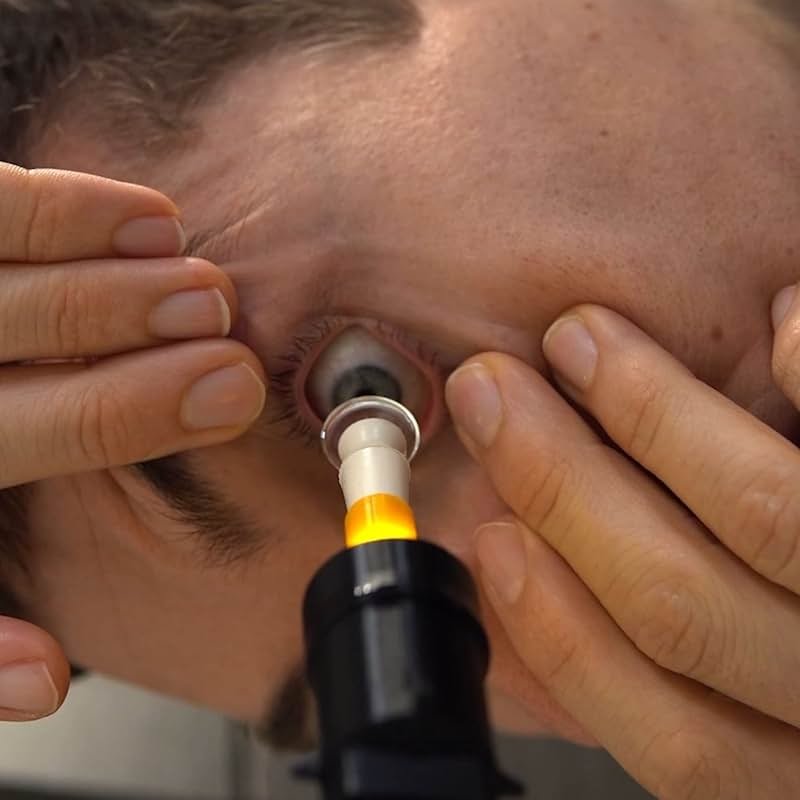 S5 Mini™: for Easy and Accurate Scleral & Hybrid Lens Insertion - Perfectly Align Your Eye with The Center of The Lens and Use 2 Hands to Hold Your Eyelids Open - Product Image