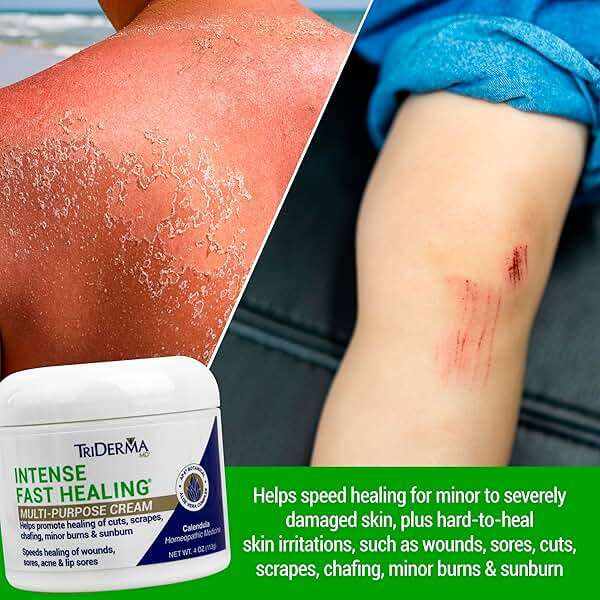 TriDerma Intense Fast Healing Cream, Decreases Healing Time for Minor Irritations, Rashes, Scrapes, Cuts 4 Ounces - Image 2