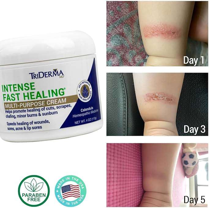 TriDerma Intense Fast Healing Cream, Decreases Healing Time for Minor Irritations, Rashes, Scrapes, Cuts 4 Ounces - Image 3