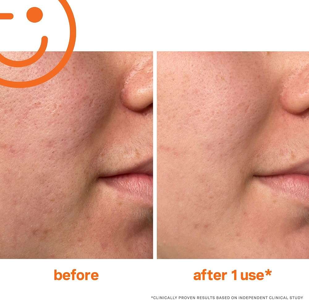 Kate Somerville ExfoliKate Intensive Exfoliating Treatment – Salicylic Acid and Lactic Acid Super Facial Scrub Improves Texture and Pores, 2 Fl Oz - Image 3