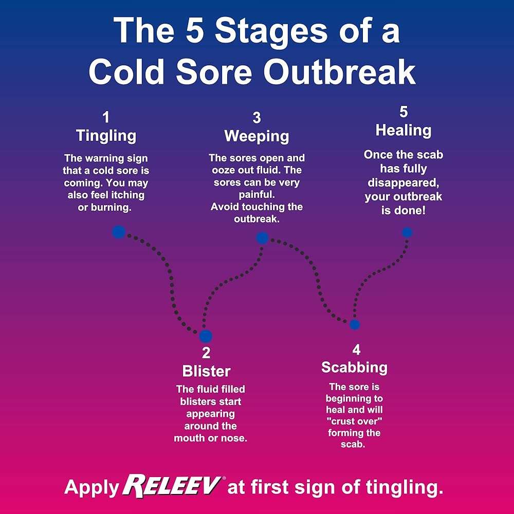 Releev 1Day Cold Sore Treatment Liquid, Fast-Acting Soothing of Pain and Itching, Topical Care for Fever Blisters & Lip Sores, 0.2 Ounces - Image 5