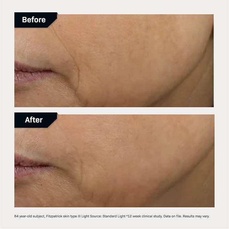 Revision Skincare D·E·J Face Cream®, Advanced Anti Aging Moisturizer, Lifting and Firming, Antioxidant Rich - Image 6
