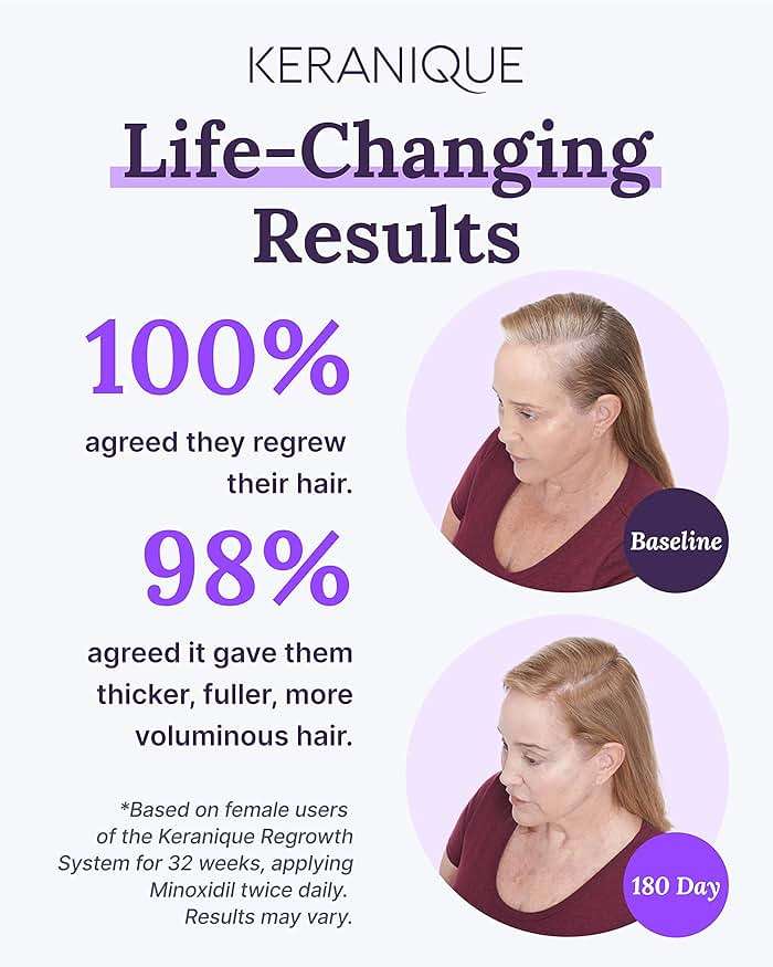 Keranique Hair Regrowth Treatment for Women - 2% Minoxidil for Hair Growth & Thickening - Topical Solution Scalp Treatment for Hair Loss & Thinning w/ Precision Spray Applicator - 2 Fl Oz - Image 3